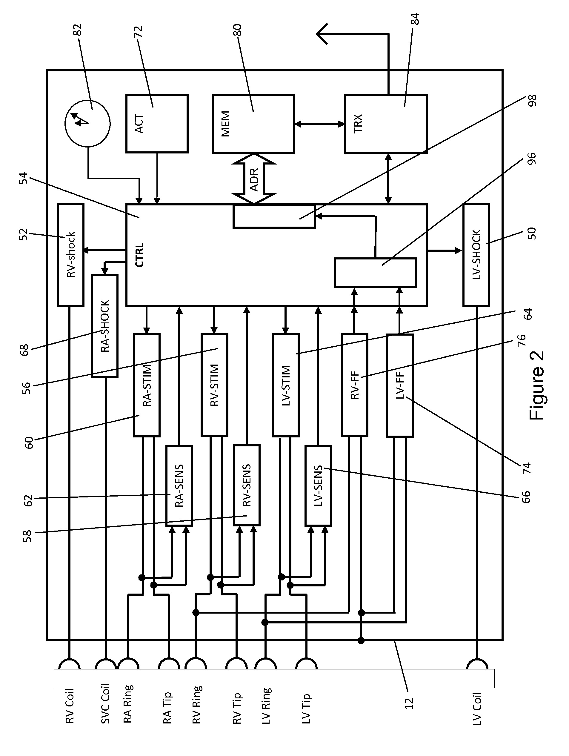 Device and method for fusion beat detection