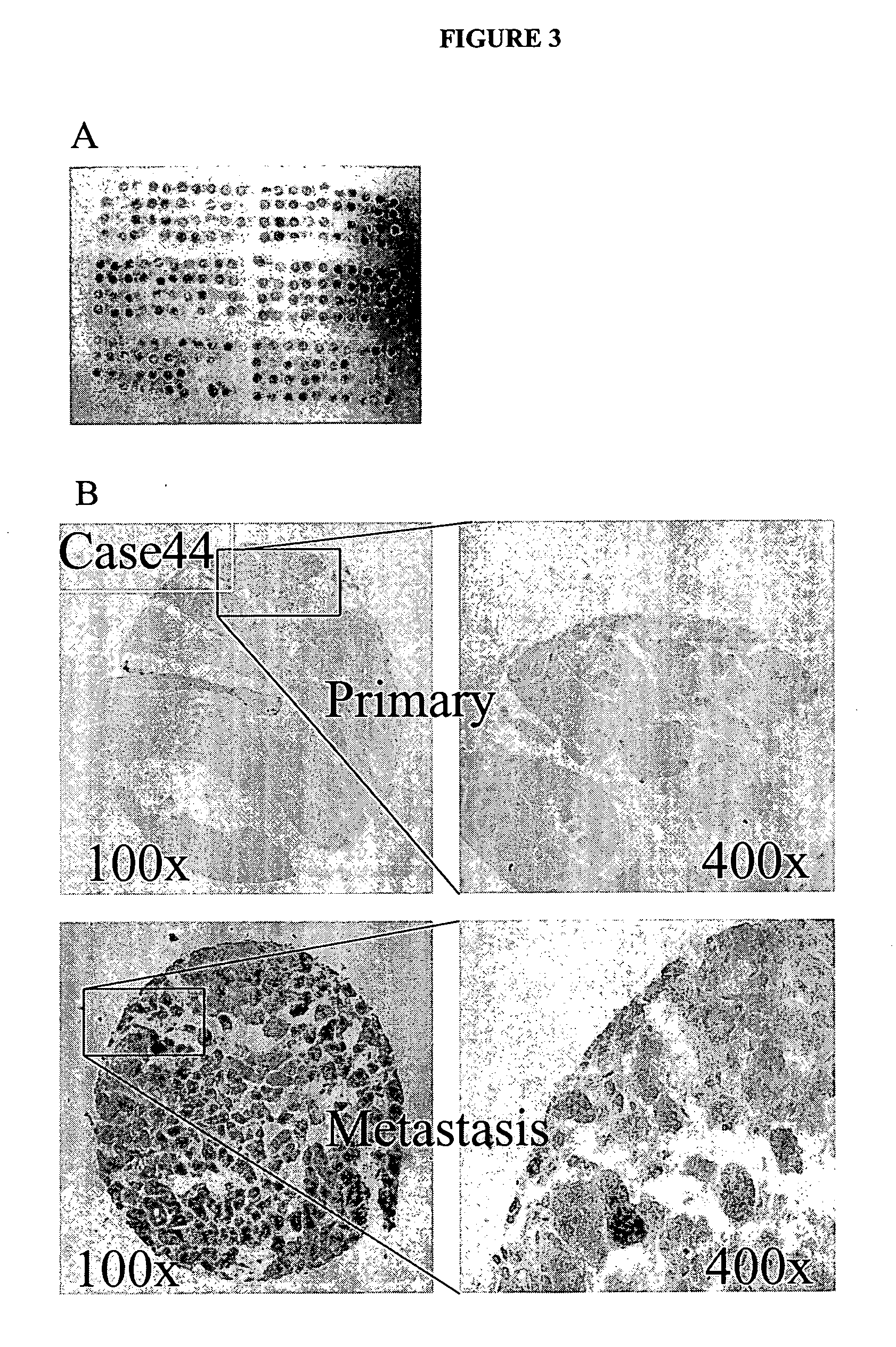 Cytotoxicity mediation of cells evidencing surface expression of CD63