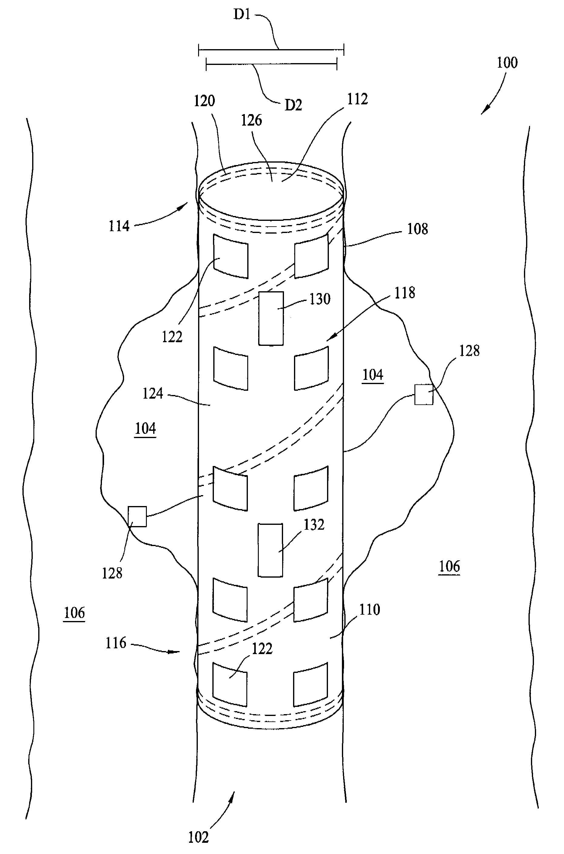 Methods and systems for monitoring an endoprosthetic implant