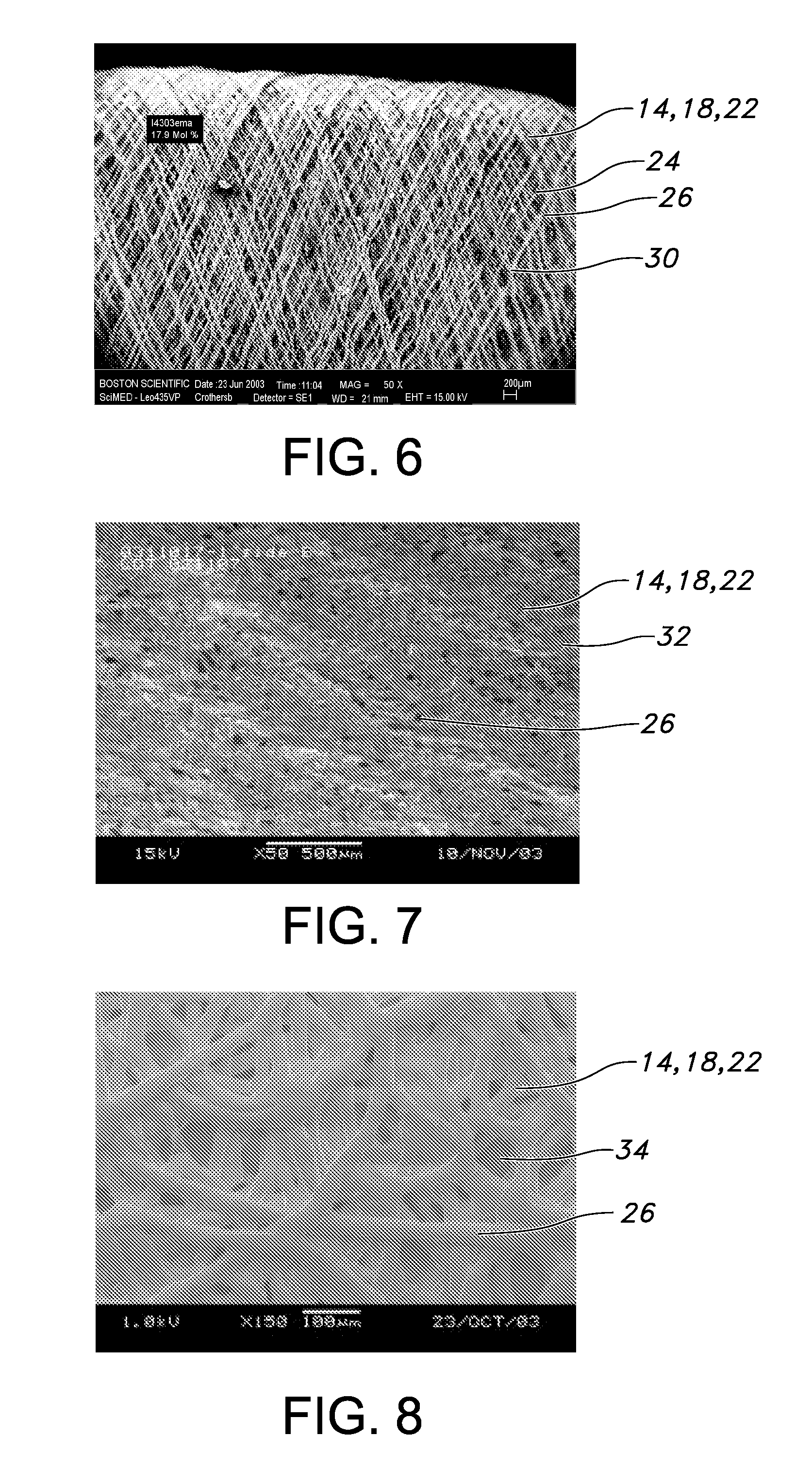 Blood acess apparatus and method