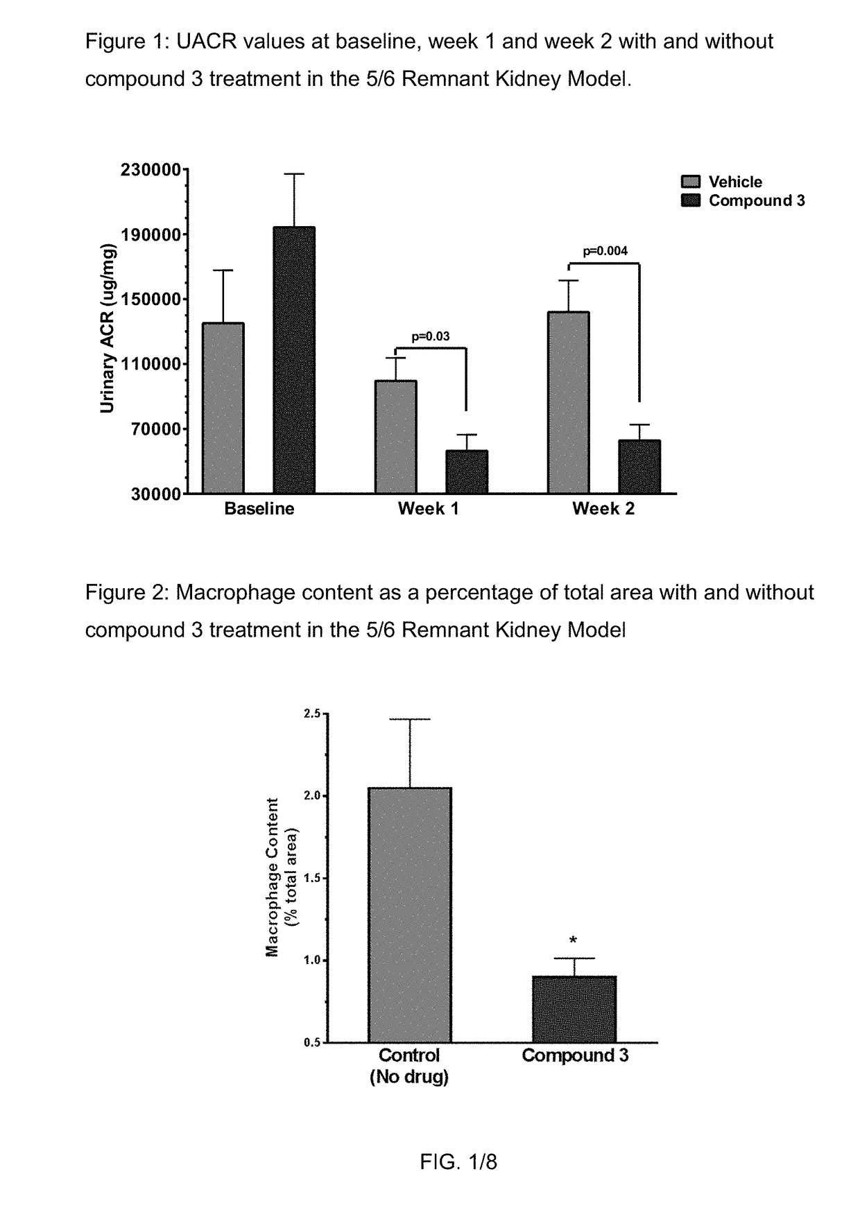 Method of treating focal segmental glomerulosclerosis