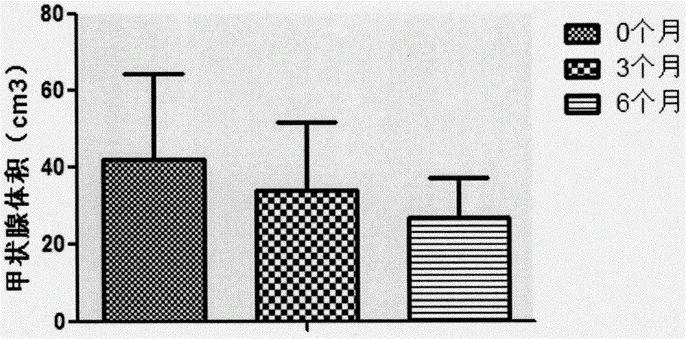 Pharmaceutical composition for treating Hashimoto's thyroiditis and preparation method thereof