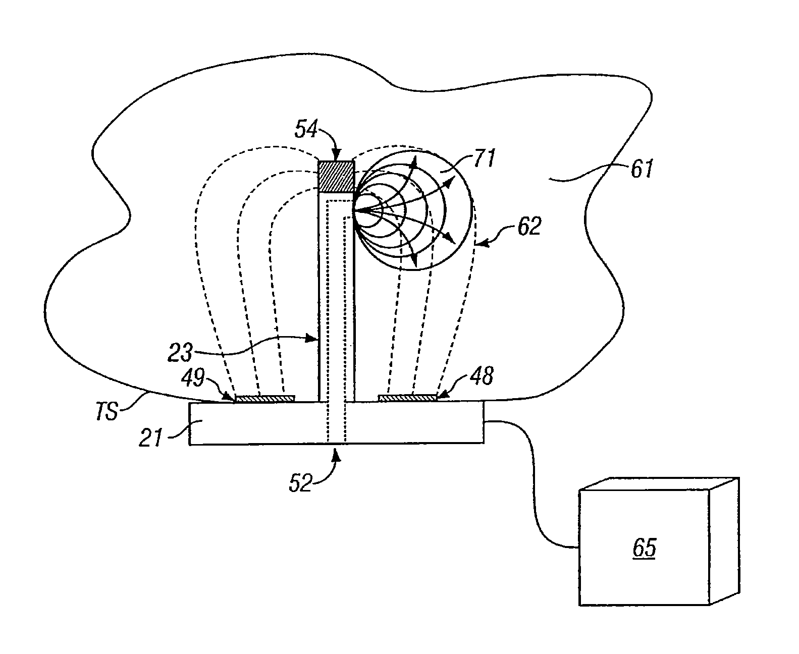 Electroporation microneedle and methods for its use