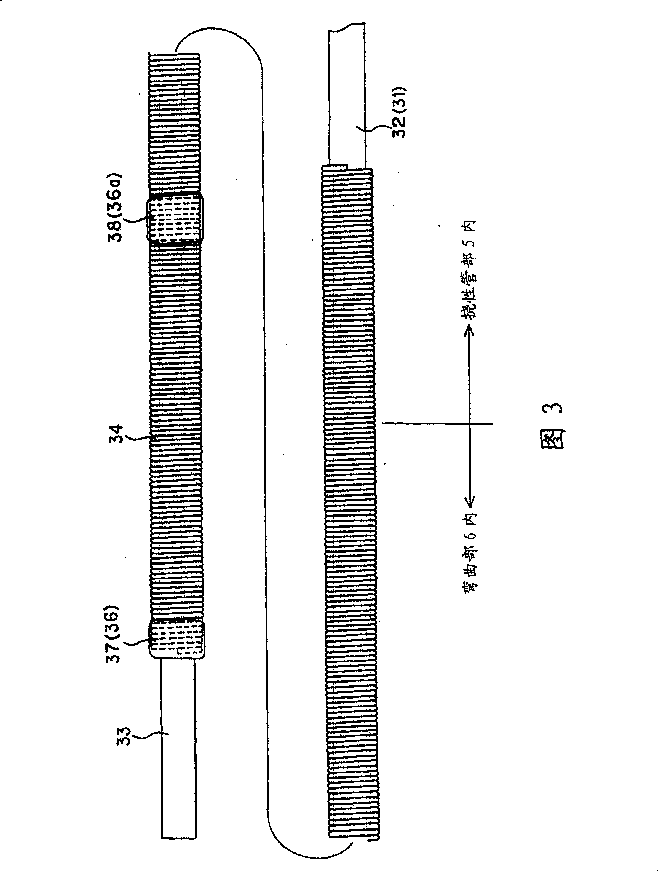 Endoscope