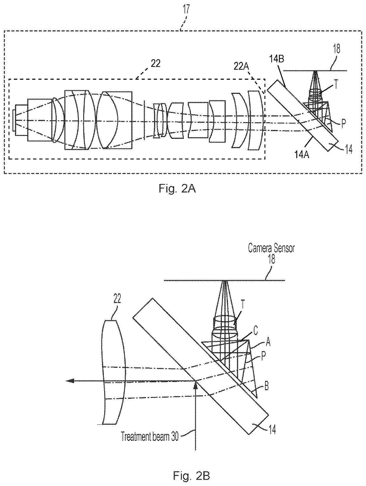 Miniature imaging system for ophthalmic laser beam delivery system