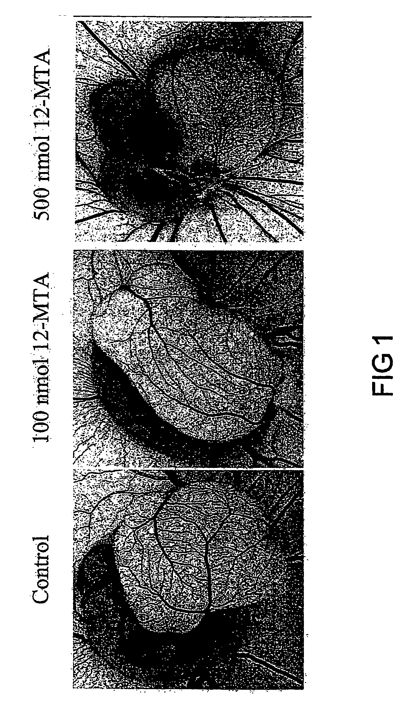 Method of inhibiting angiogenesis