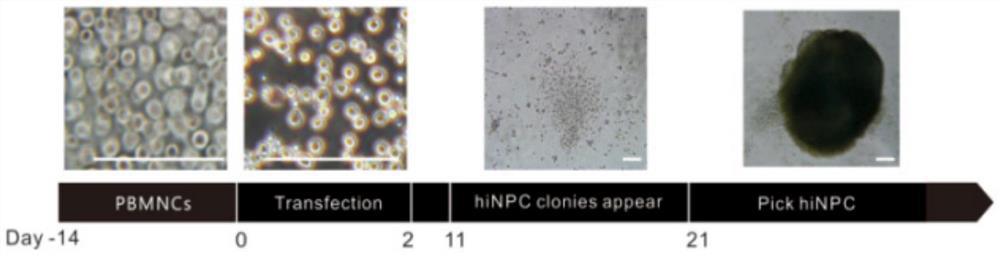 Application of Rassf6 as marker of Alzheimer's disease