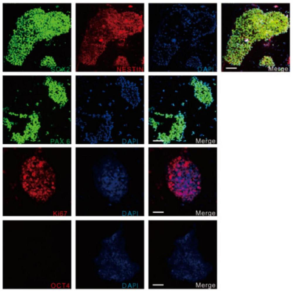 Application of Rassf6 as marker of Alzheimer's disease