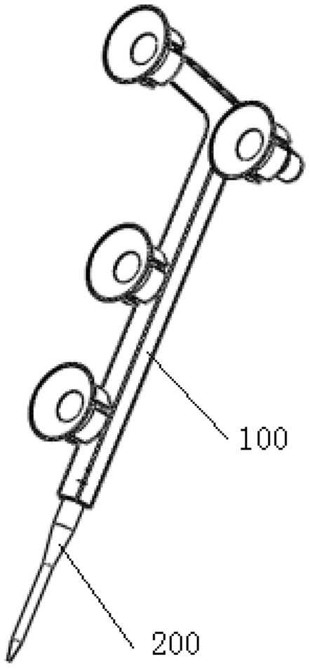 A joint replacement registration device and method