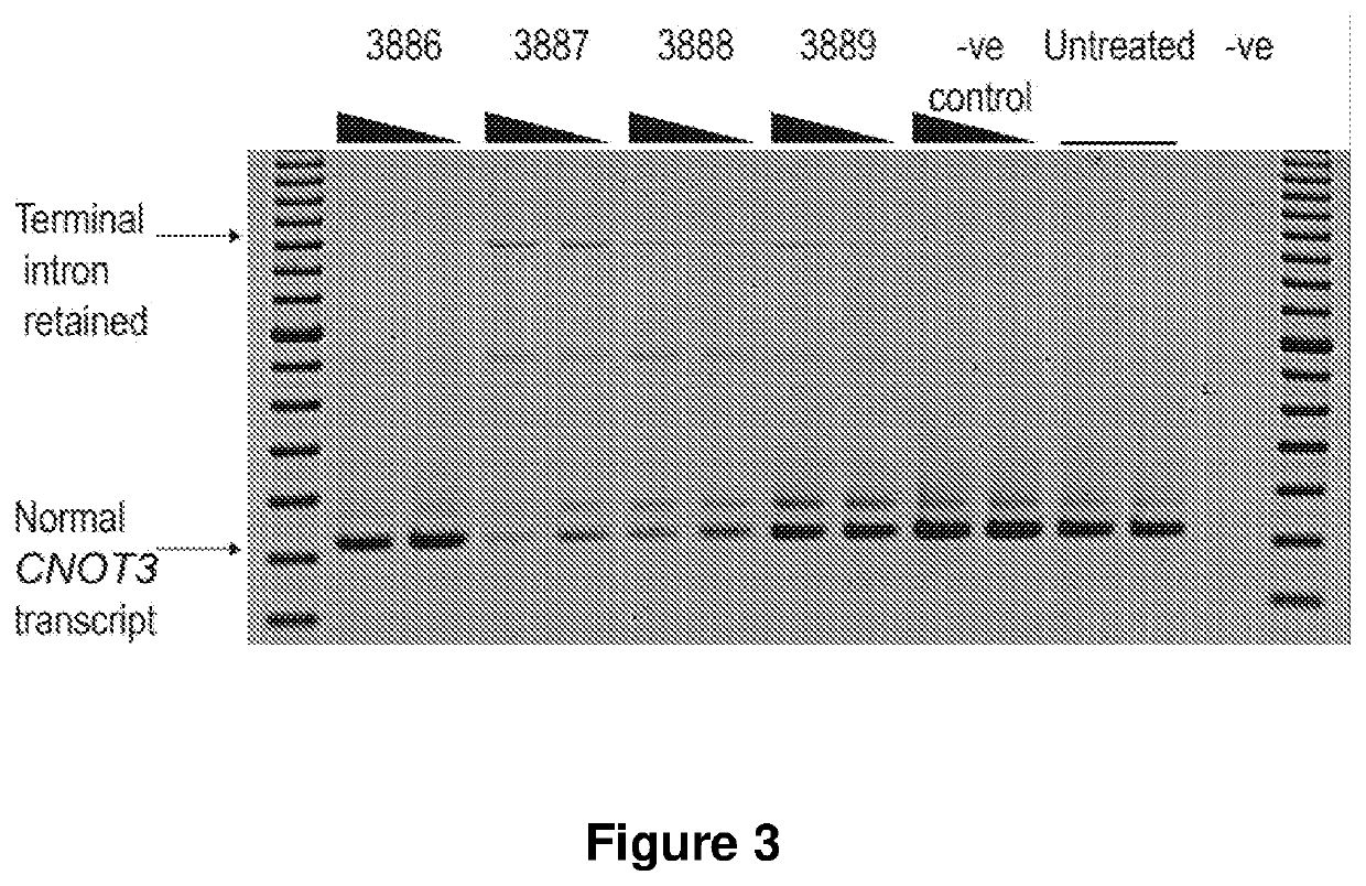 Novel Retinitis Pigmentosa Treatment