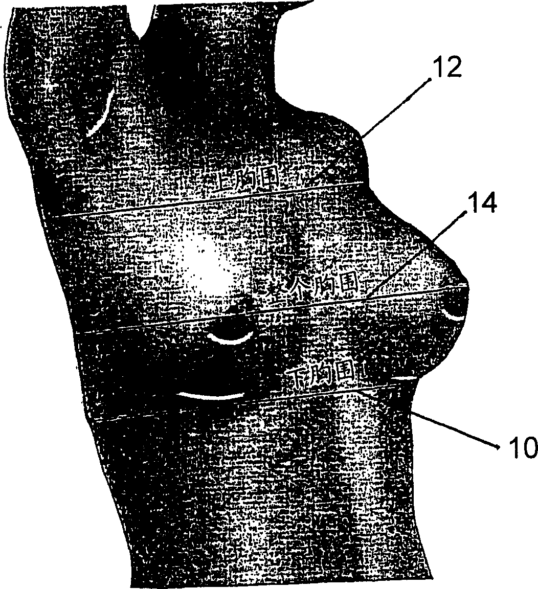 Postoperative bilateral augmentation mammaplasty brassiere