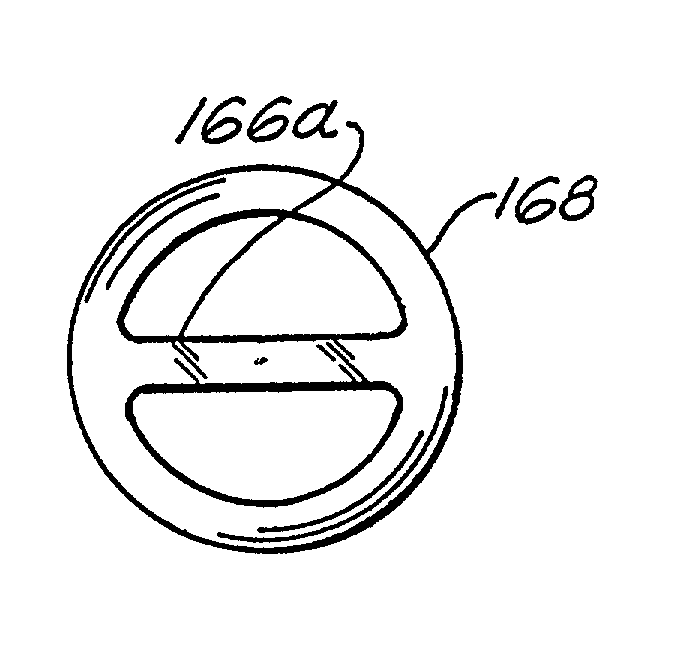 Corneal implant and method of manufacture