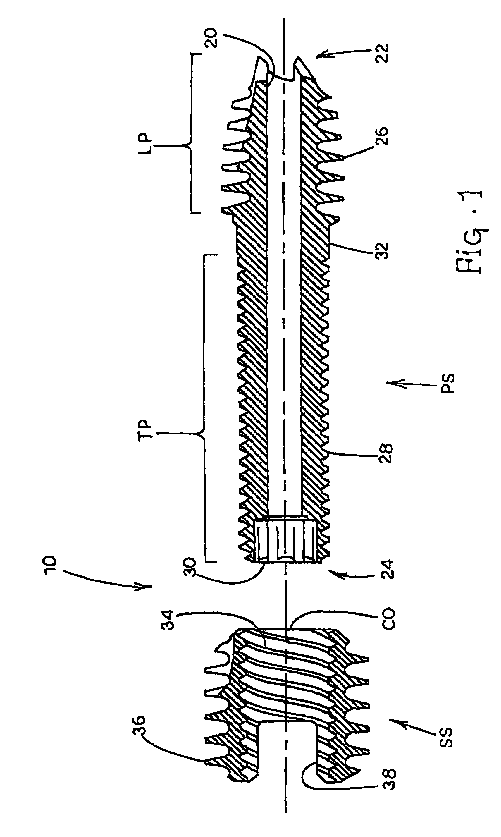 Compression screw apparatuses, systems and methods