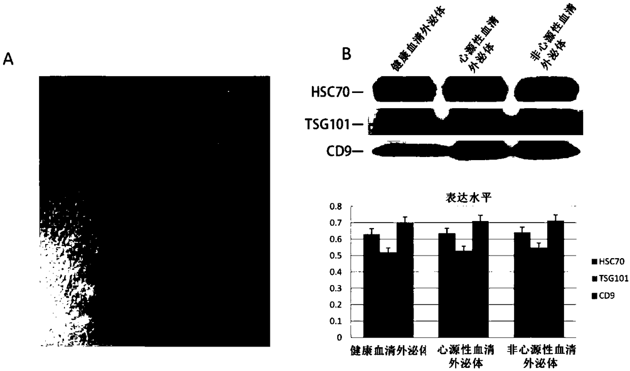 Use of microRNA in exosomes for diagnosis of cerebral arterial thrombosis