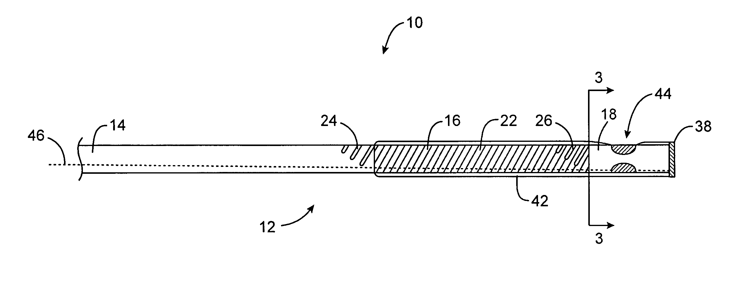 Steerable distal support system