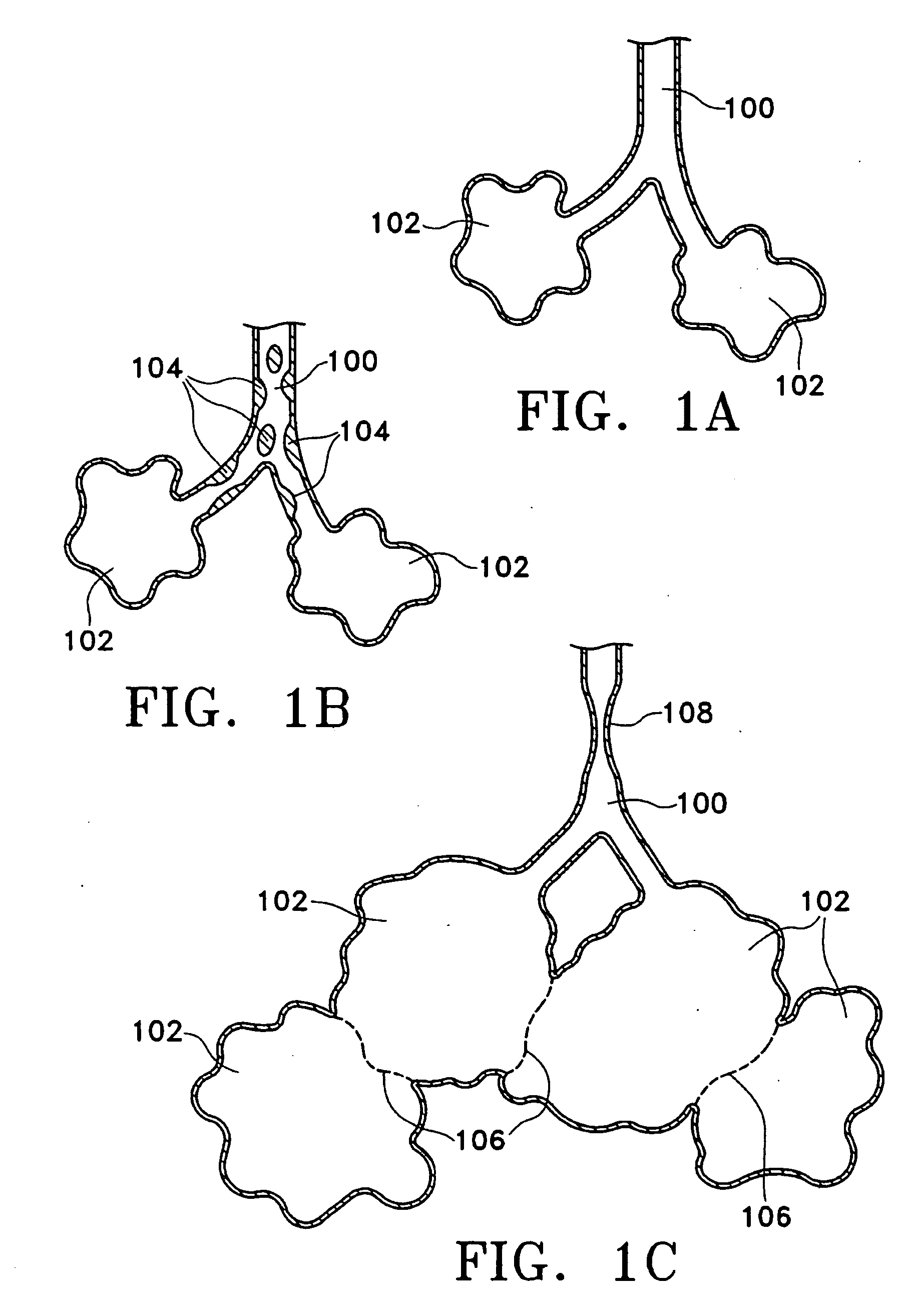 Methods for maintaining the patency of collateral channels in the lungs using cryo-energy