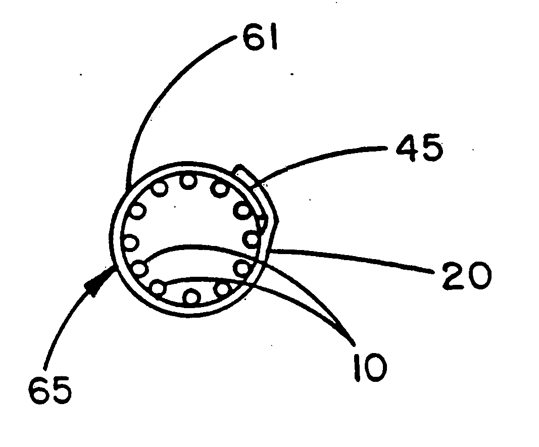 Intraluminal stent graft