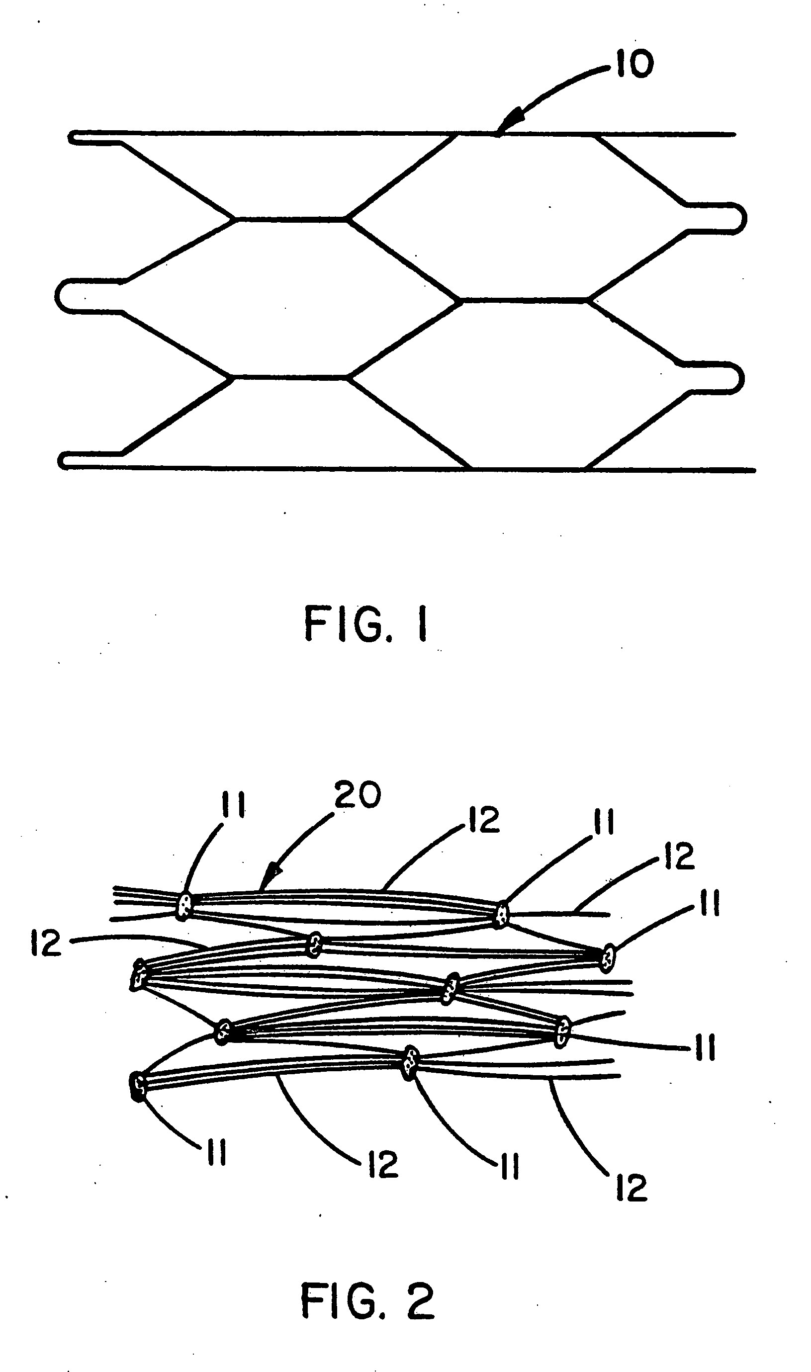 Intraluminal stent graft