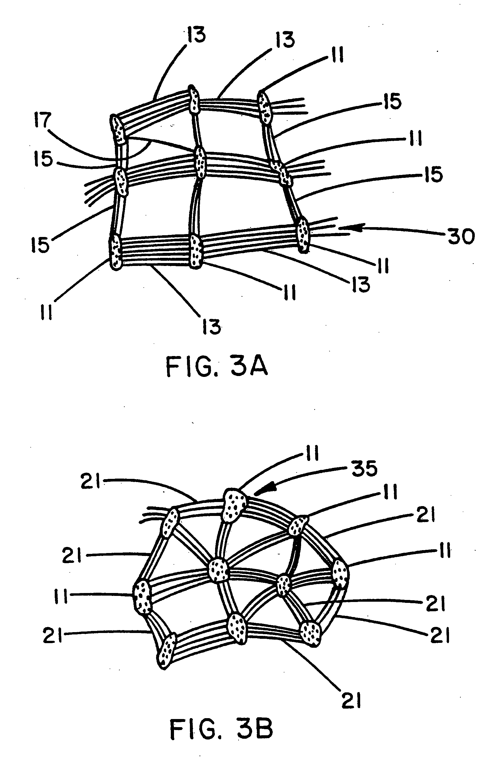 Intraluminal stent graft