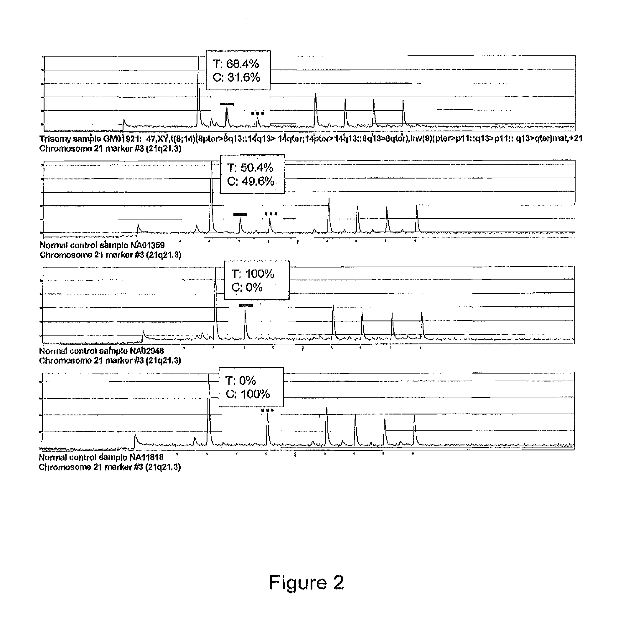 Method of Prenatal Molecular Diagnosis of Down Syndrome and Other Trisomic Disorders