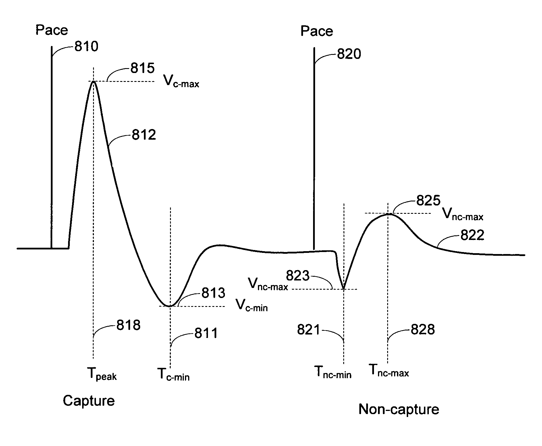 Cardiac pacing response classification based on waveform feature variability