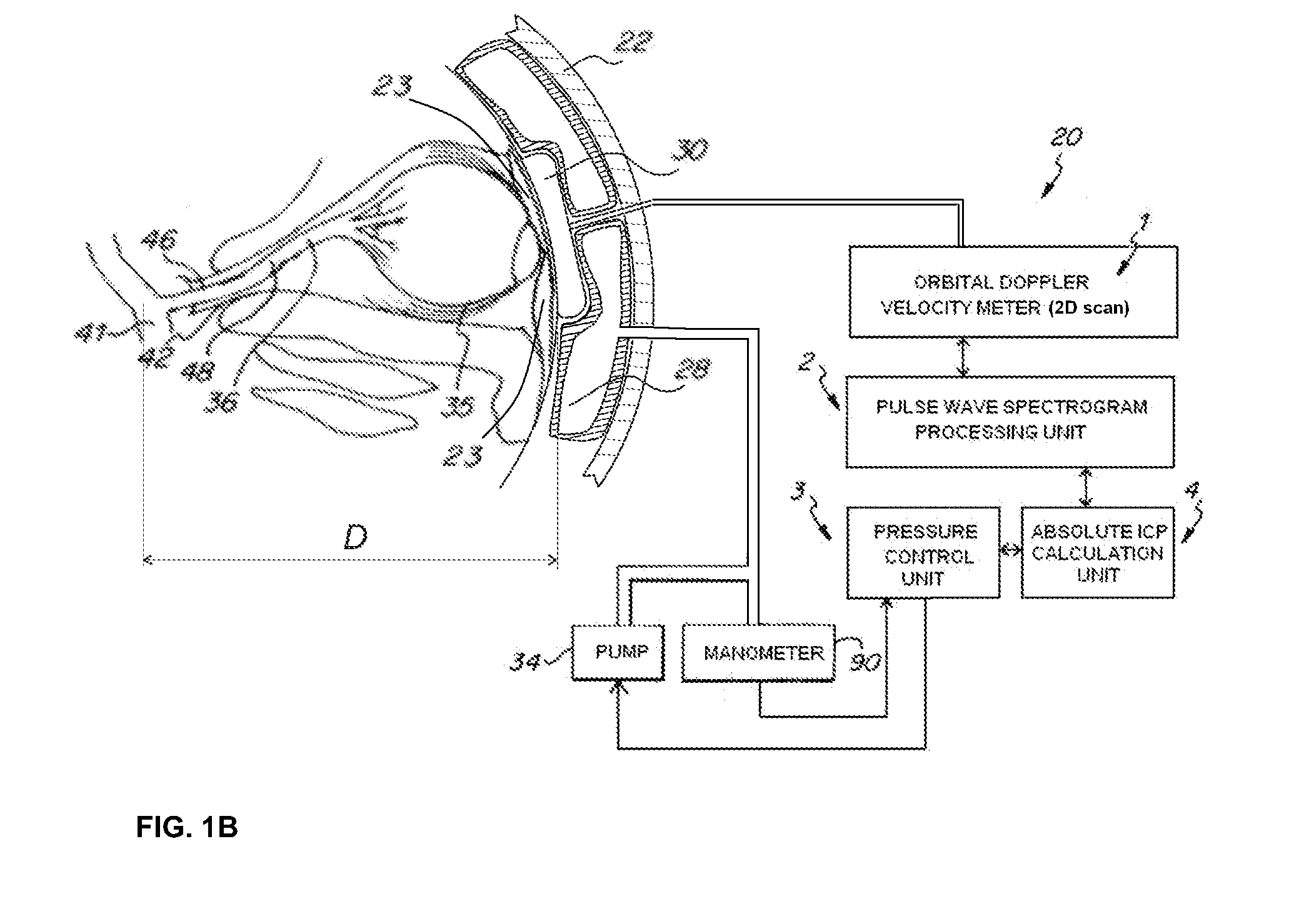 Method and Apparatus For Determining The Absolute Value Of Intracranial Pressure