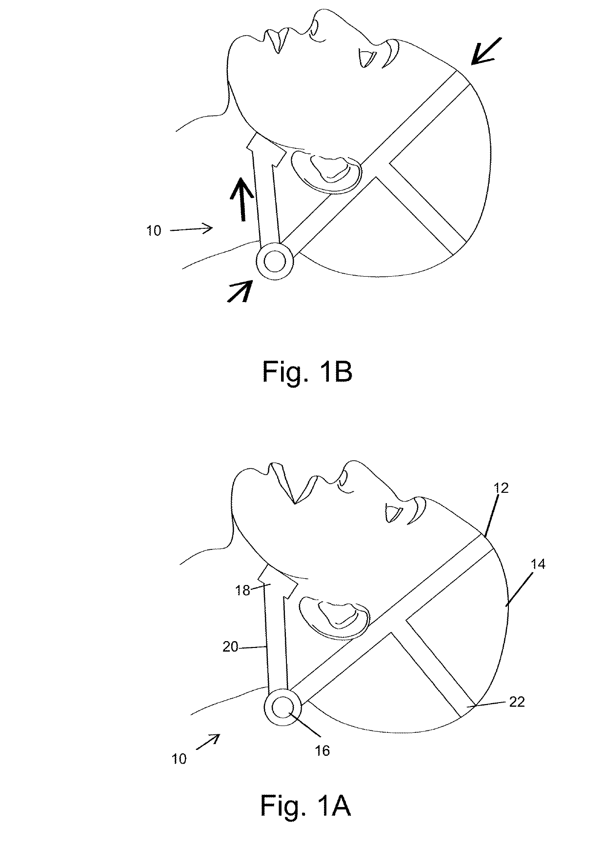 Device for optimal airway opening