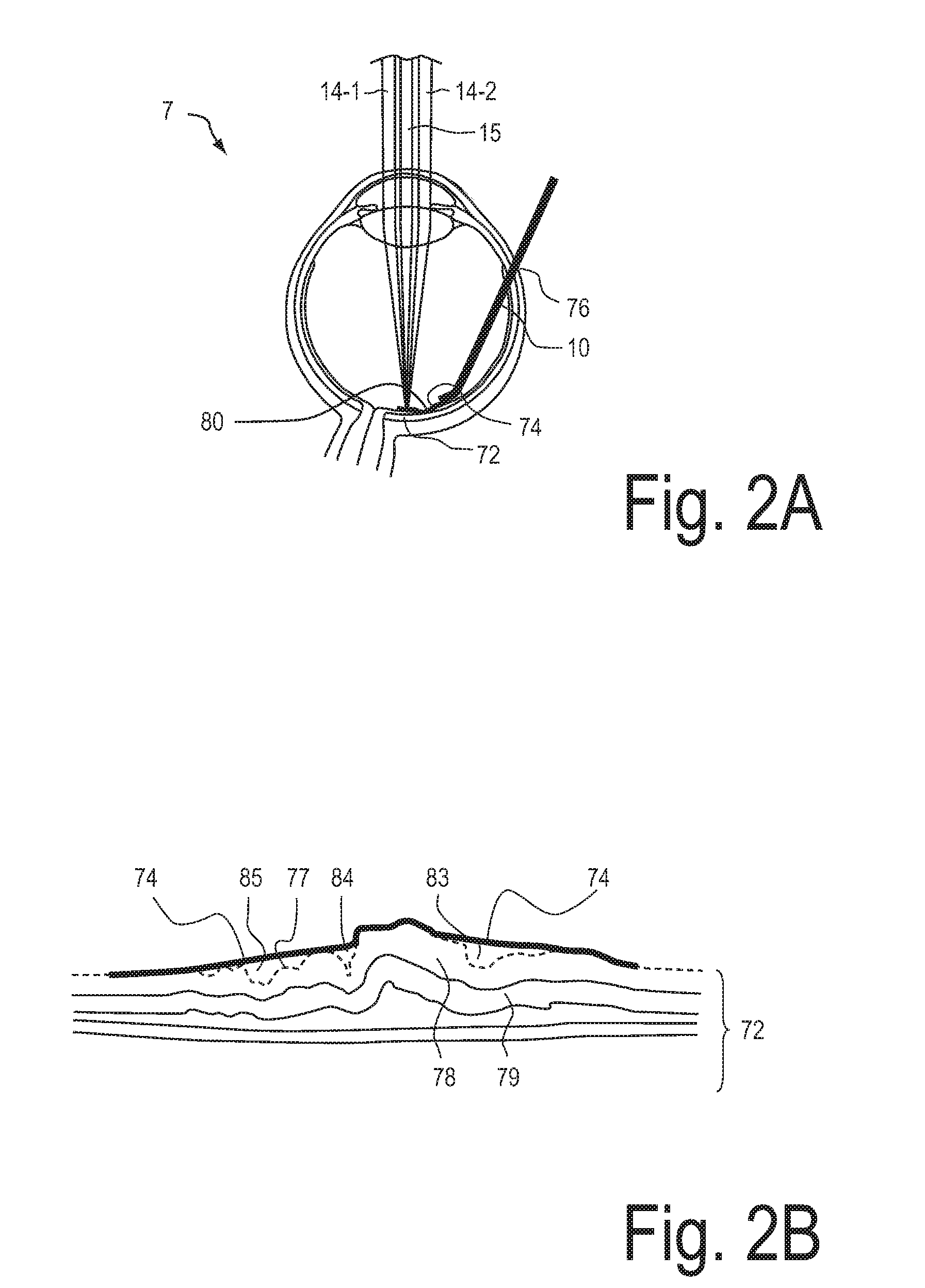 System for eye examination by means of stress-dependent parameters