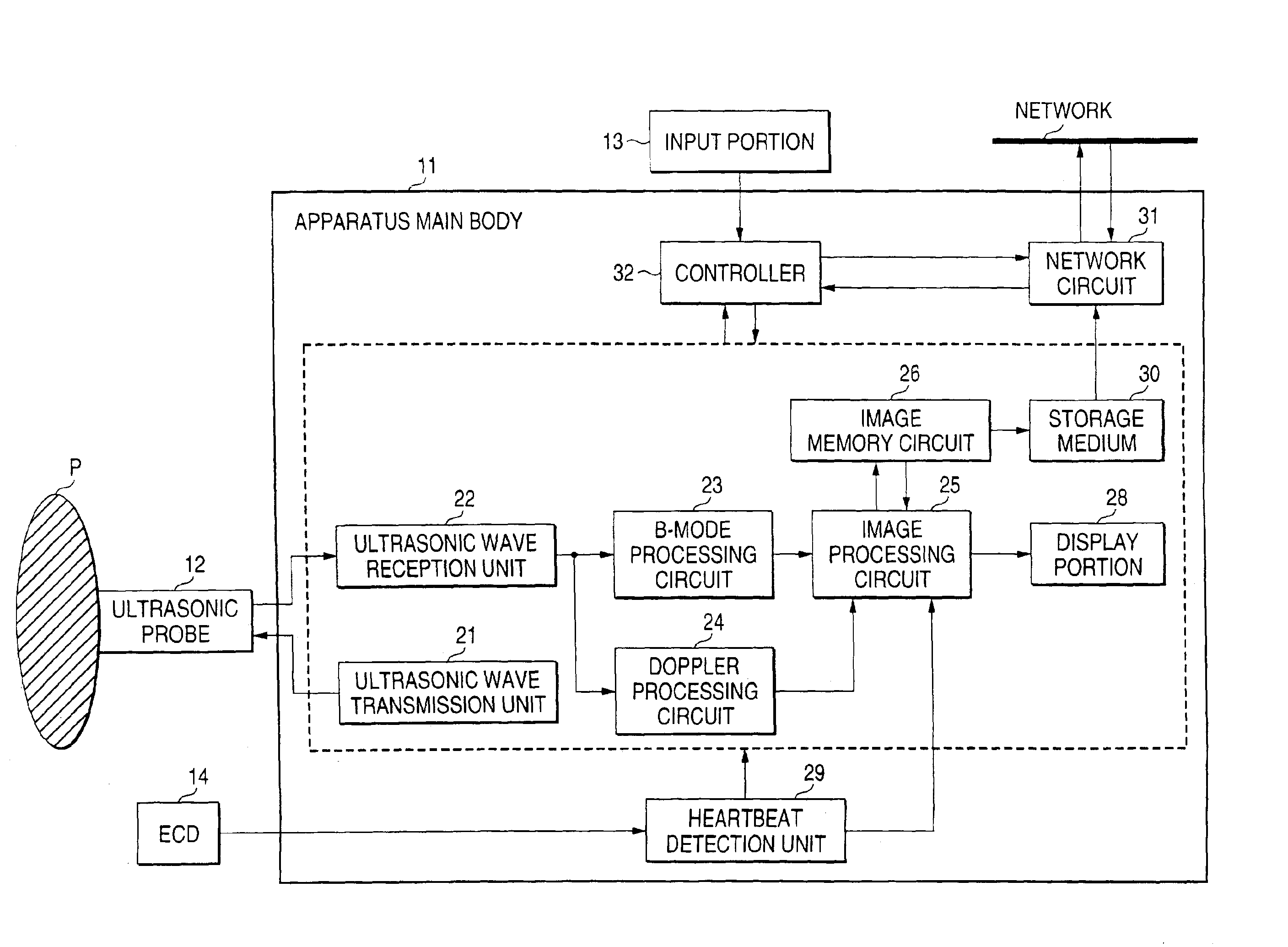 Ultrasonic diagnosis apparatus and control method of ultrasonic diagnosis apparatus