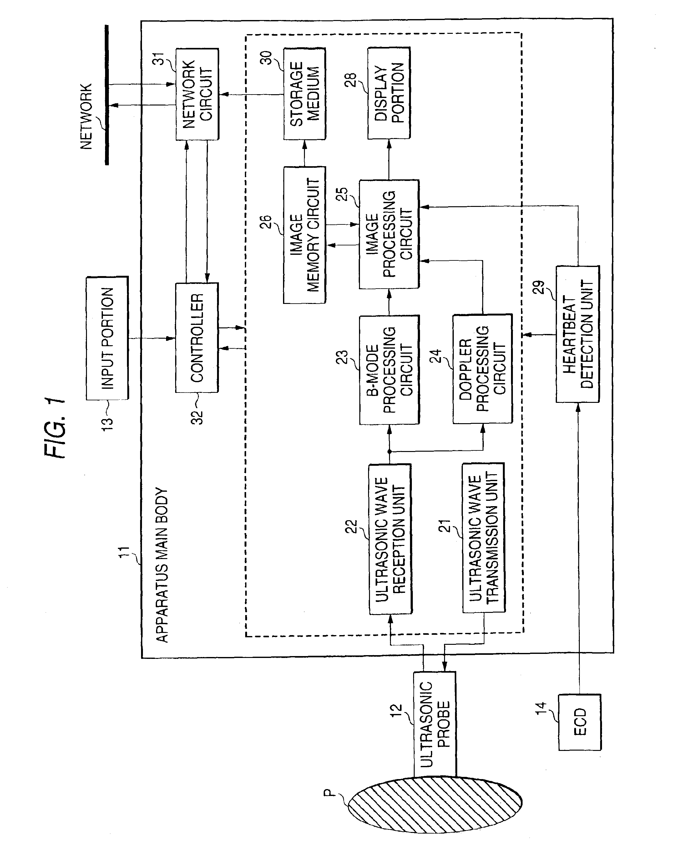 Ultrasonic diagnosis apparatus and control method of ultrasonic diagnosis apparatus