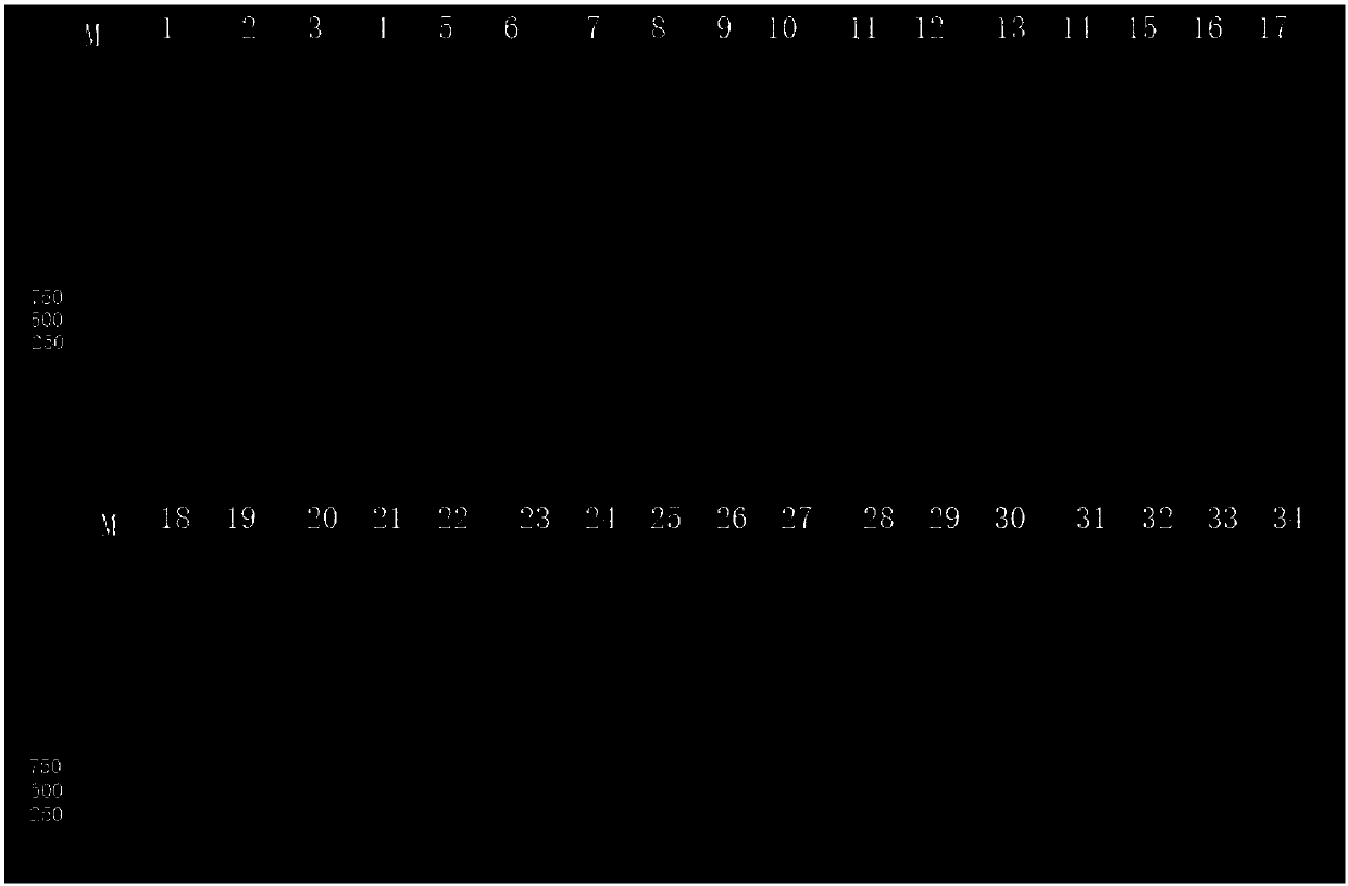 Primer set for building 16S rRNA gene amplicon sequencing library and building method