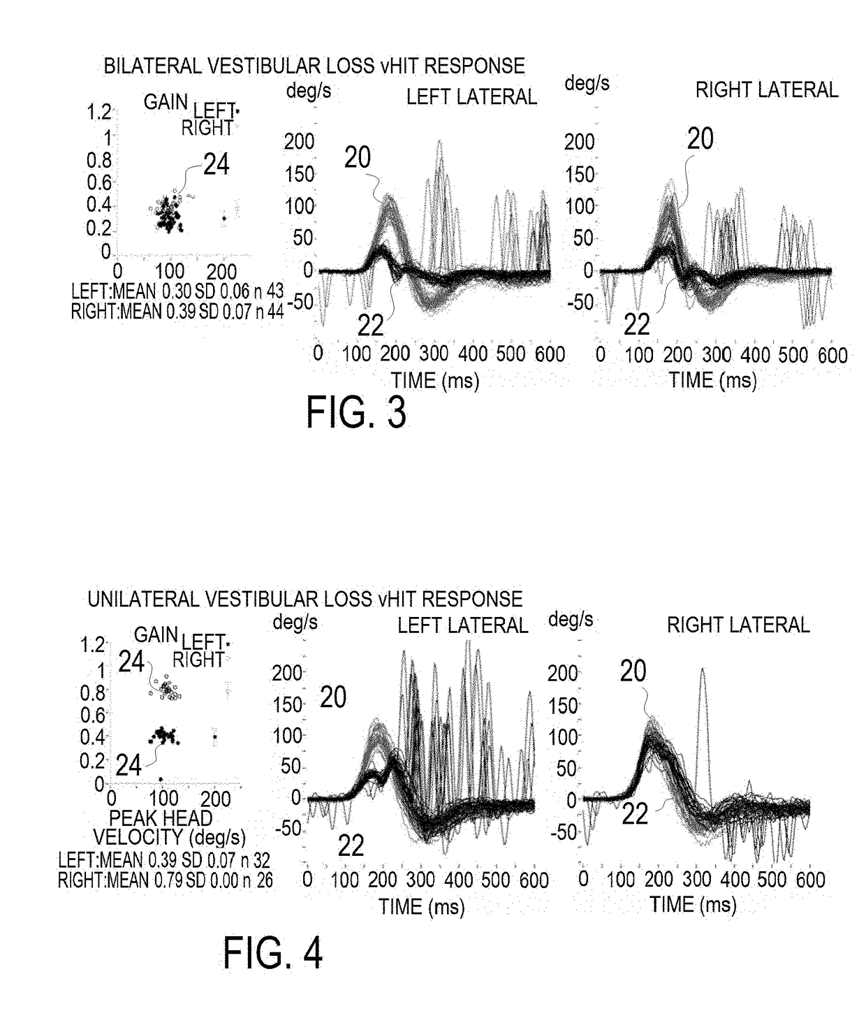 Apparatus and Method for Computerized Rotational Head Impulse Test