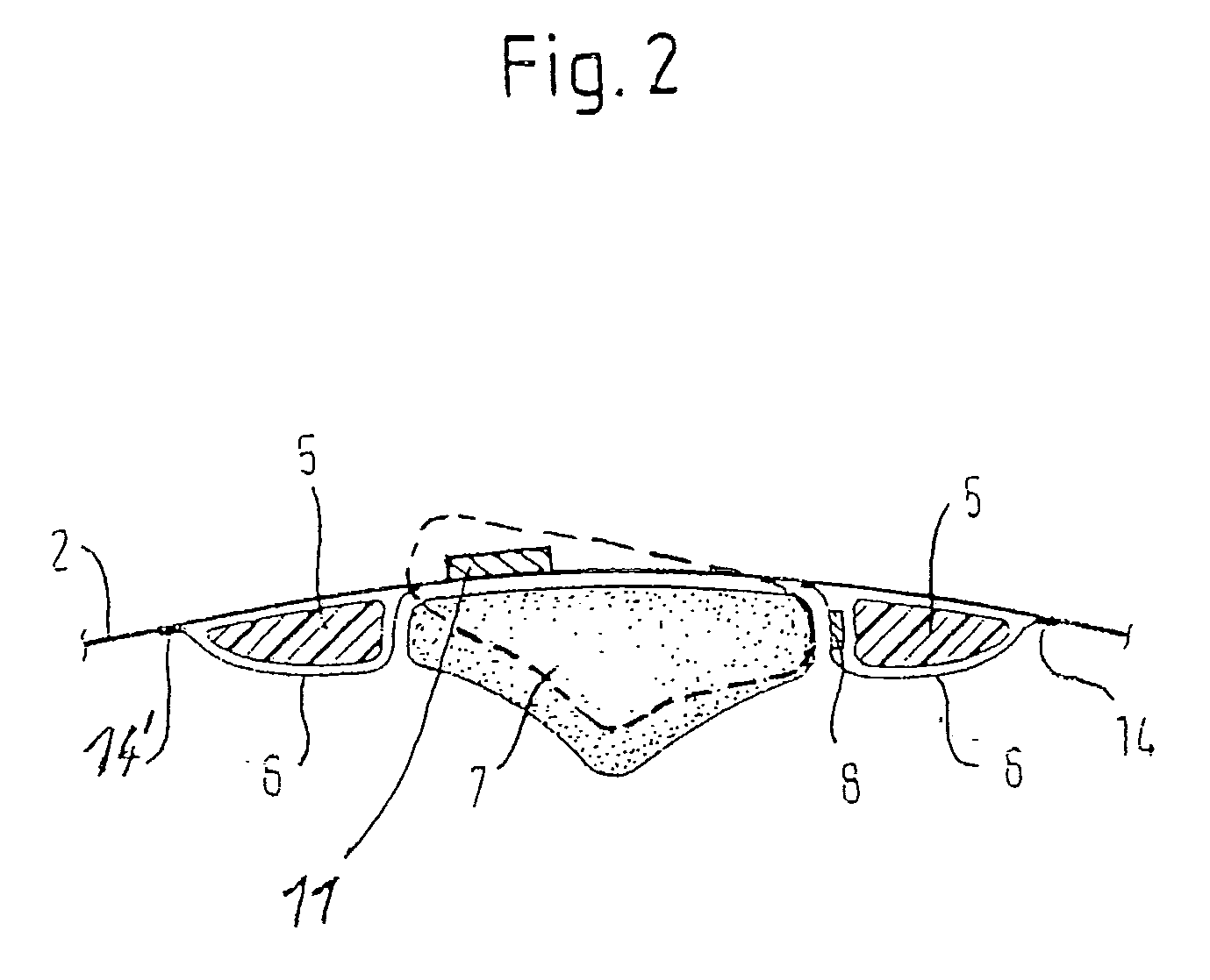 Knee joint bandage