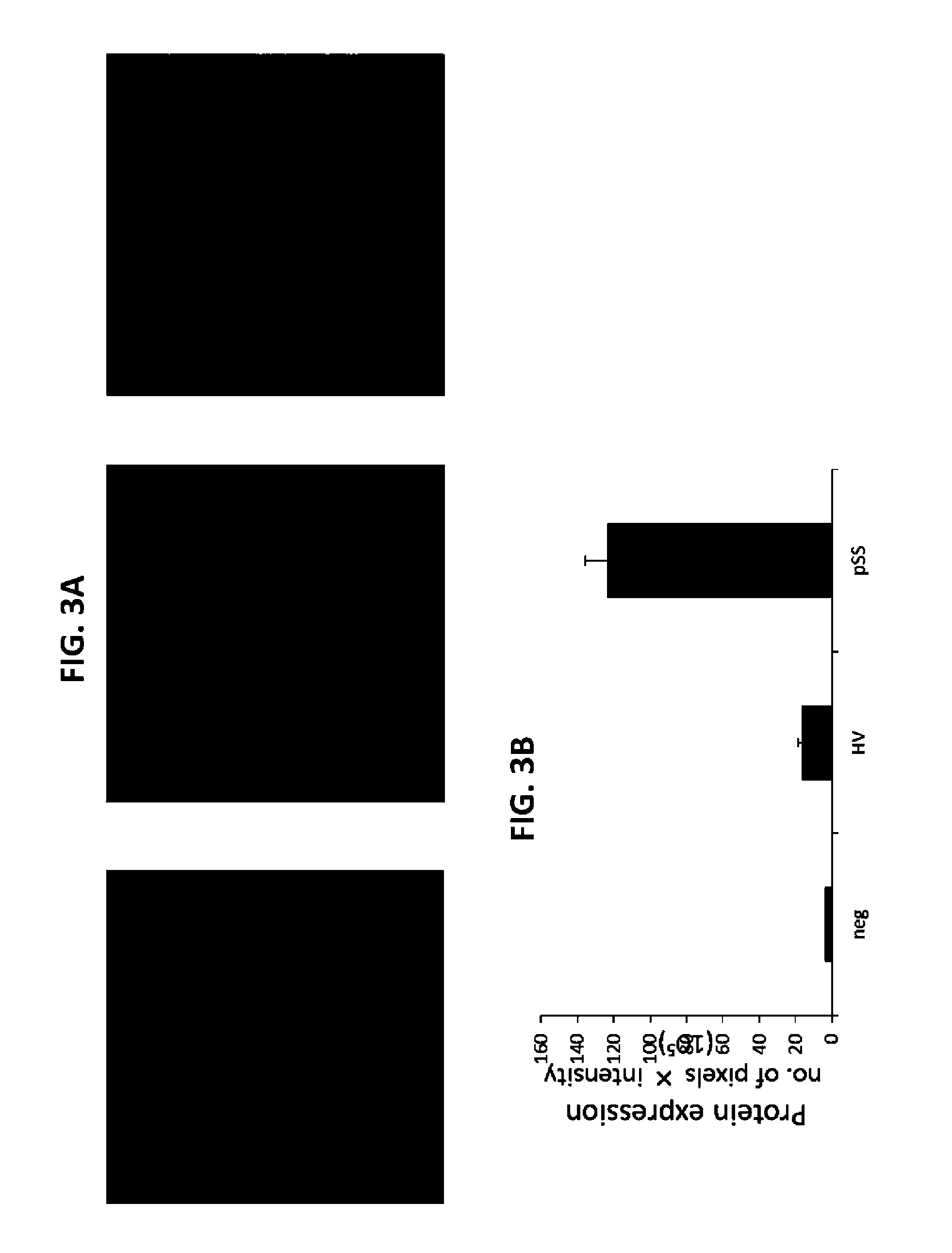 Methods for the diagnosis and treatment of sjögren's syndrome