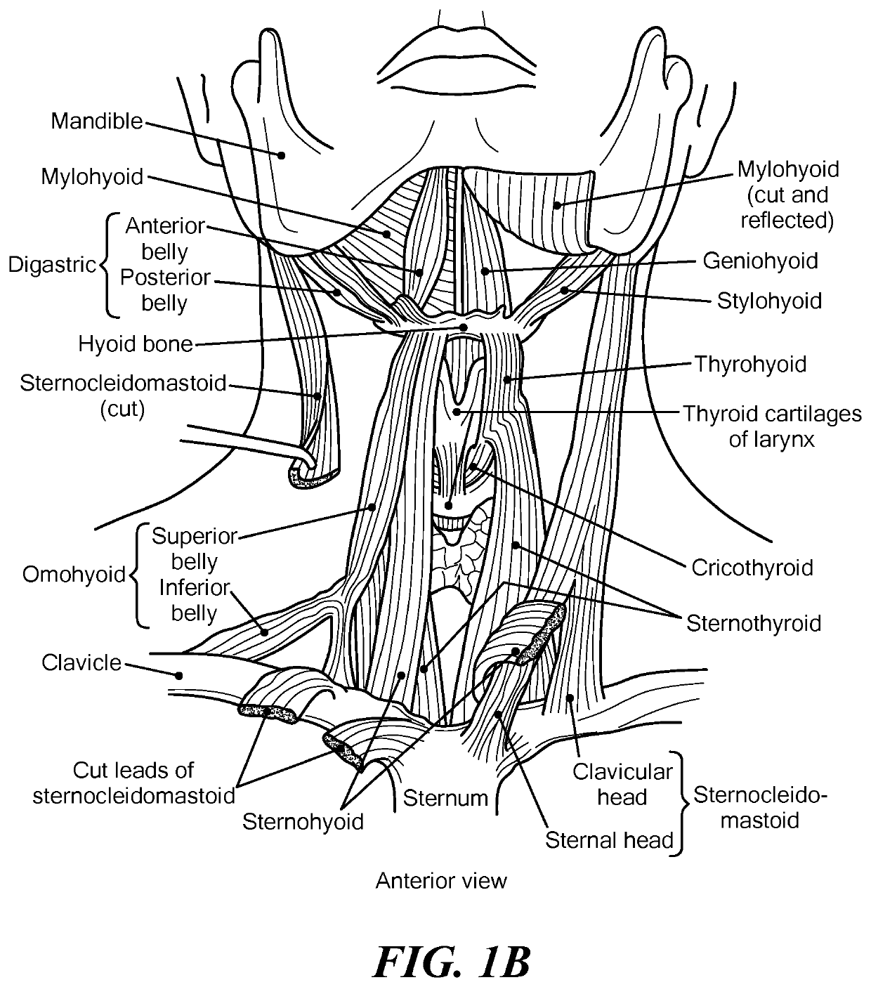 Eliciting Swallowing using Electrical Stimulation Applied via Surface Electrodes