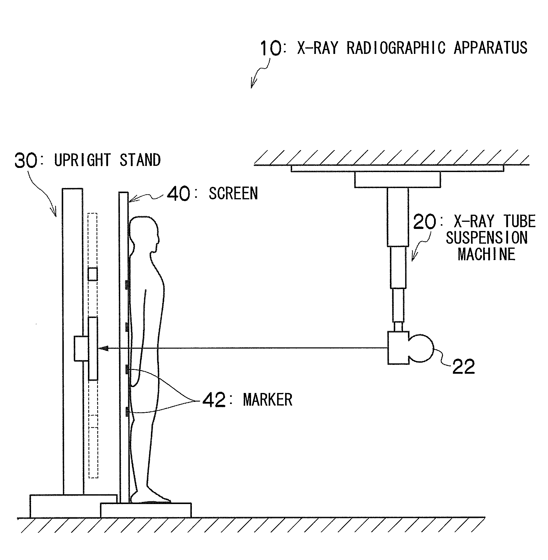 X-ray radiographic apparatus and method