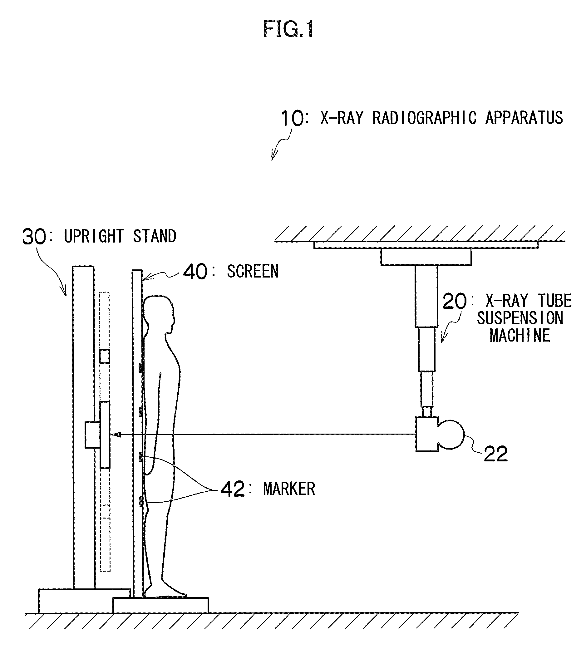 X-ray radiographic apparatus and method