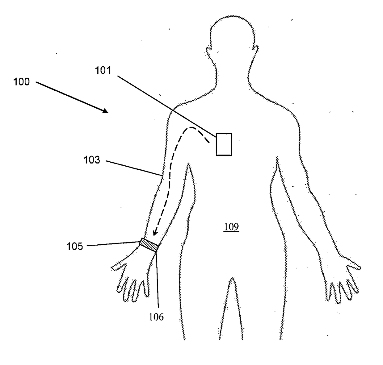 System and Method for Intra-Body Communication