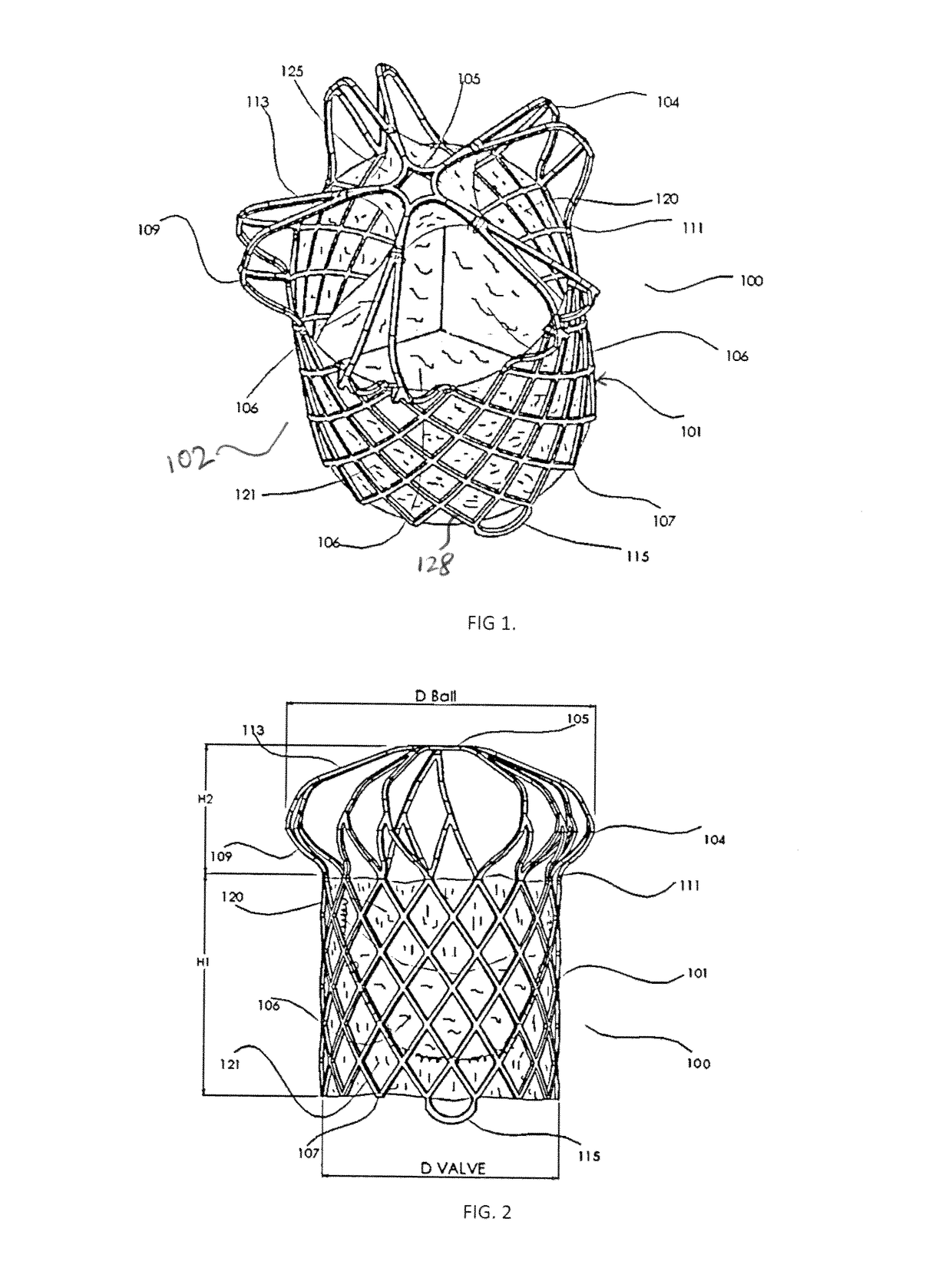 Transcatheter Pulmonary Ball Valve Assembly