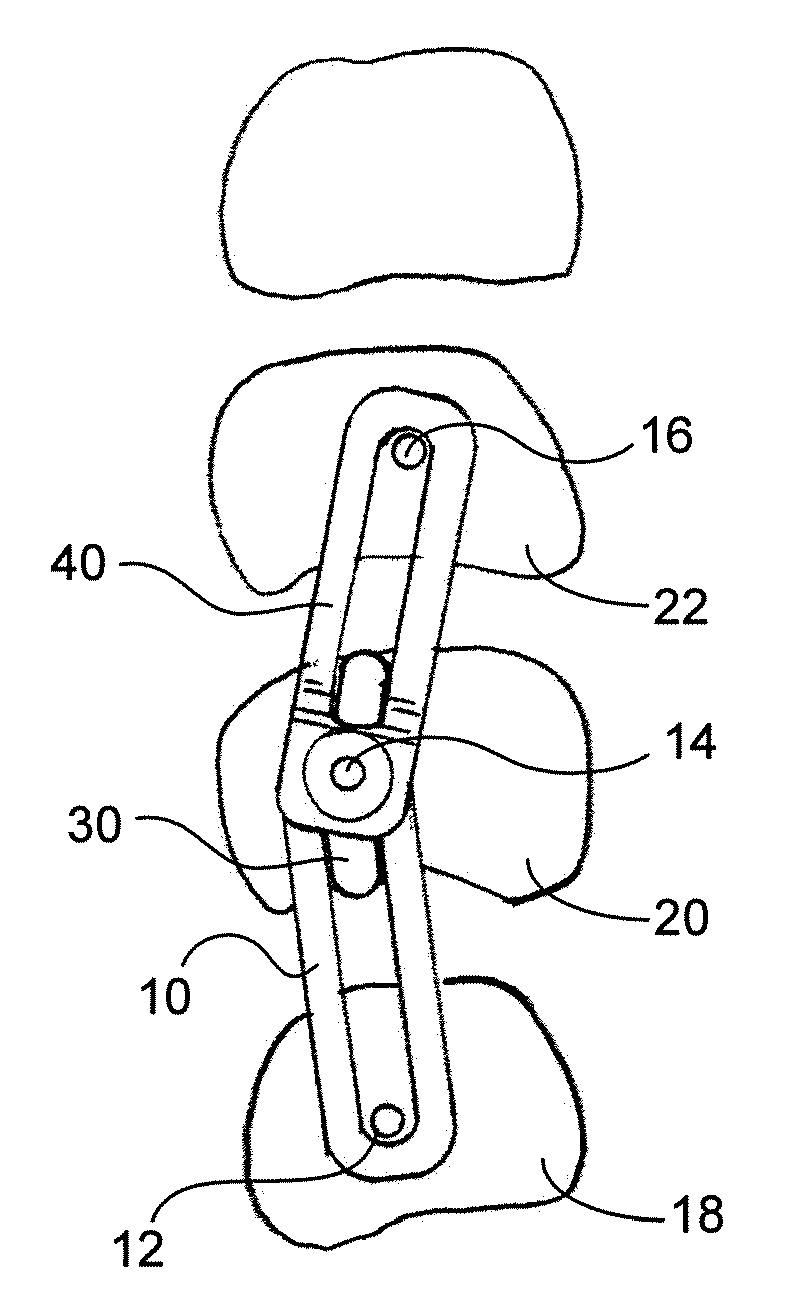 Adjustable spinal system