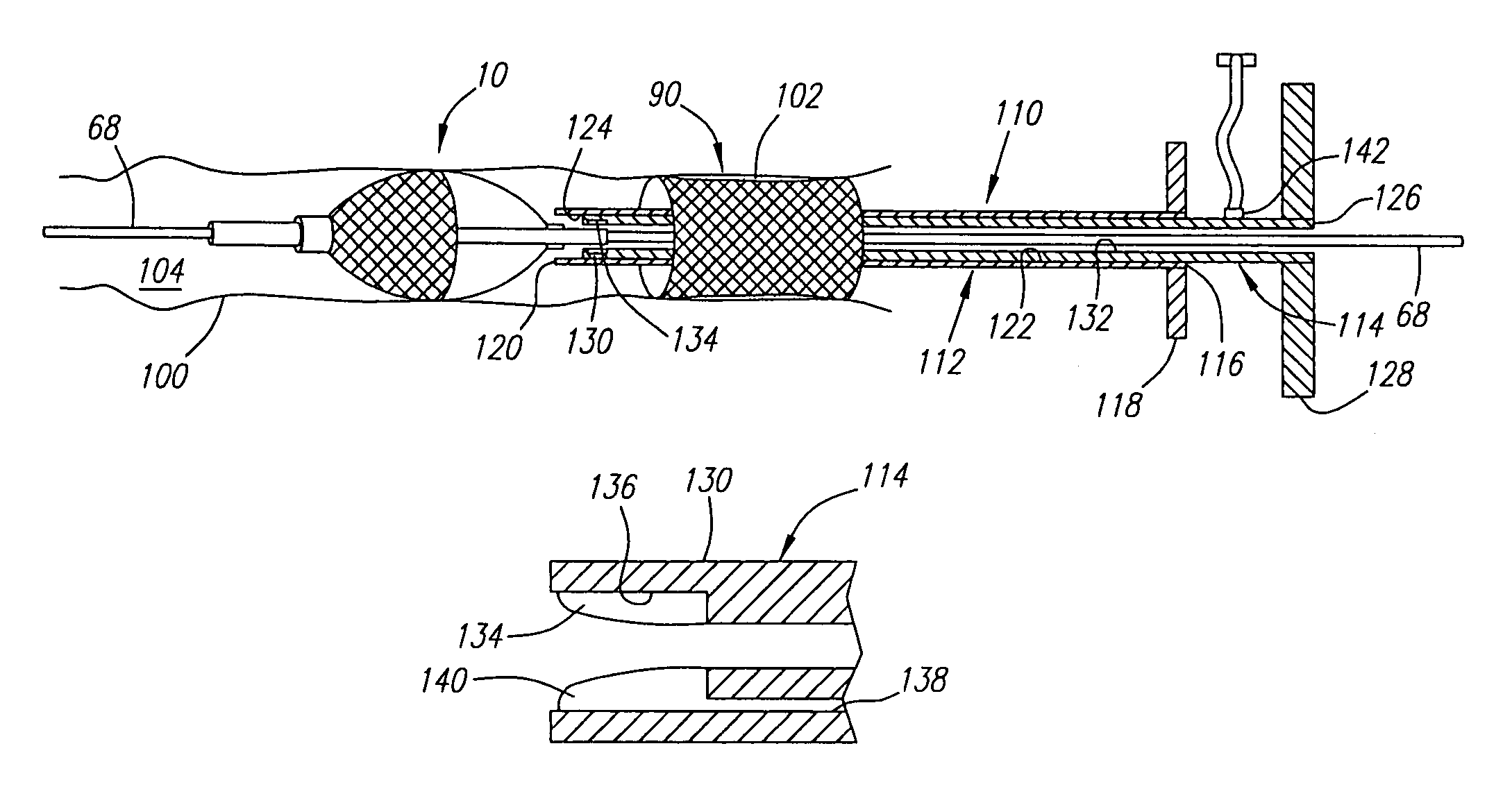 Deployable recoverable vascular filter and methods for use