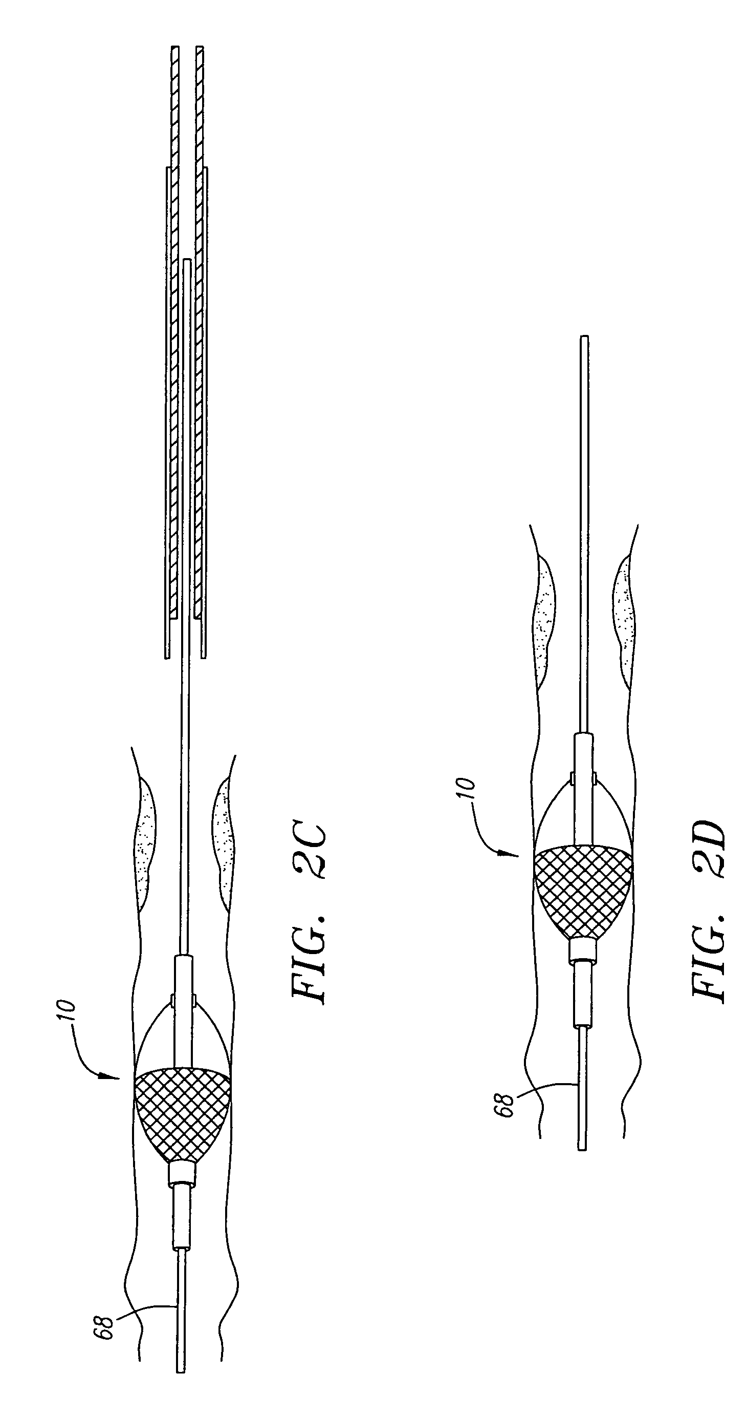 Deployable recoverable vascular filter and methods for use