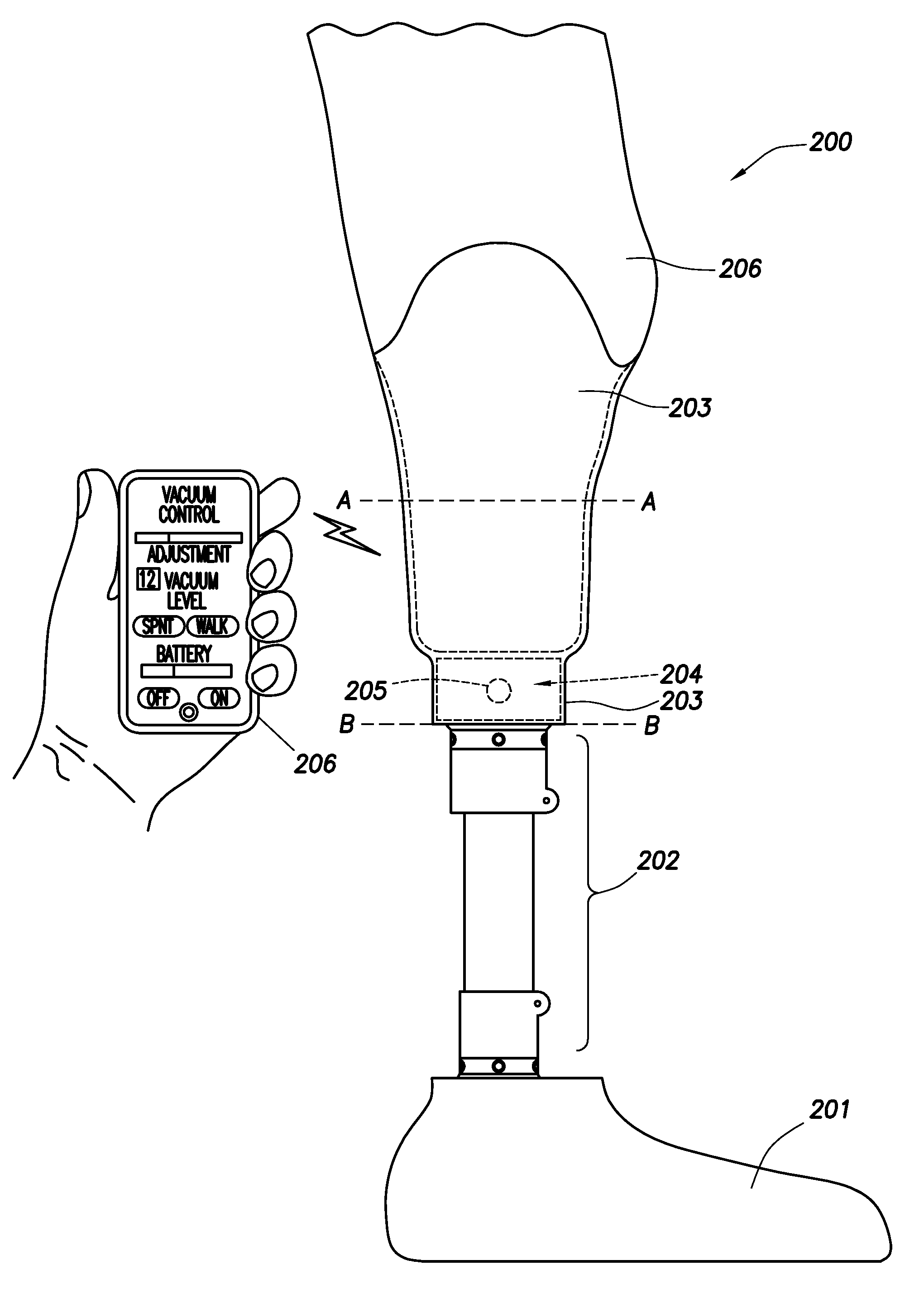 Intelligent prosthetic socket system with active user feedback interface and real time prosthesis diagnostics