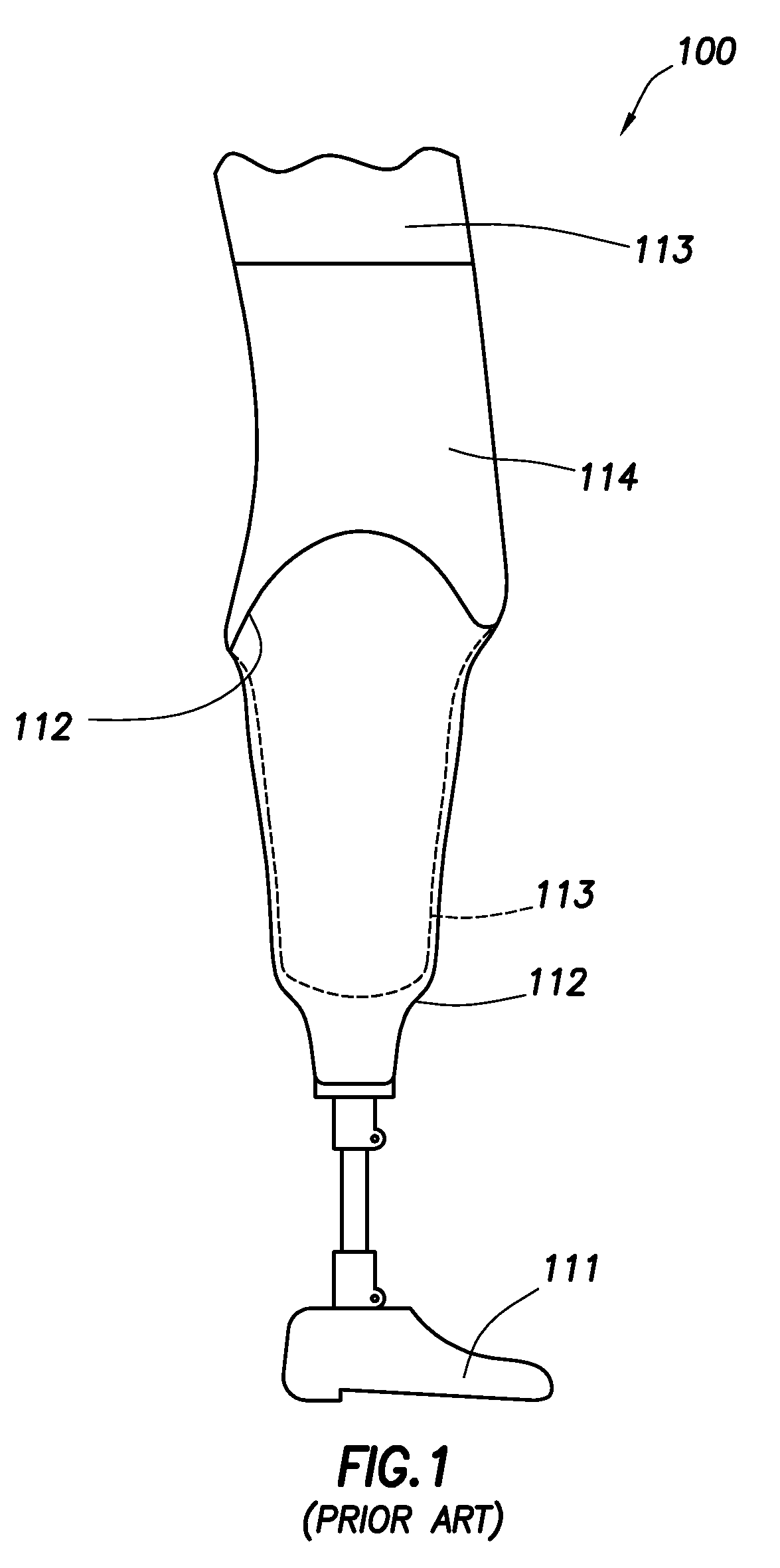 Intelligent prosthetic socket system with active user feedback interface and real time prosthesis diagnostics