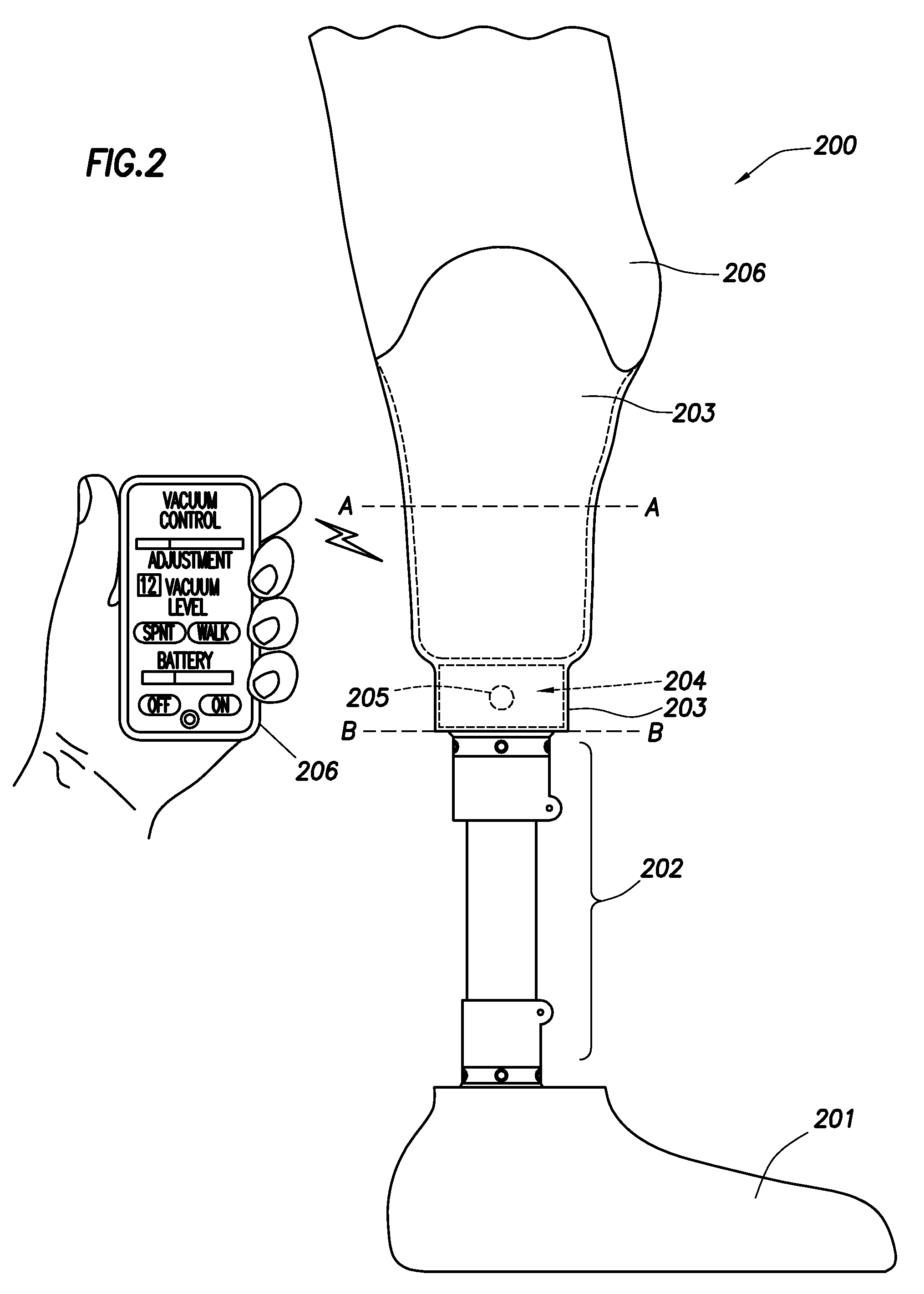 Intelligent prosthetic socket system with active user feedback interface and real time prosthesis diagnostics