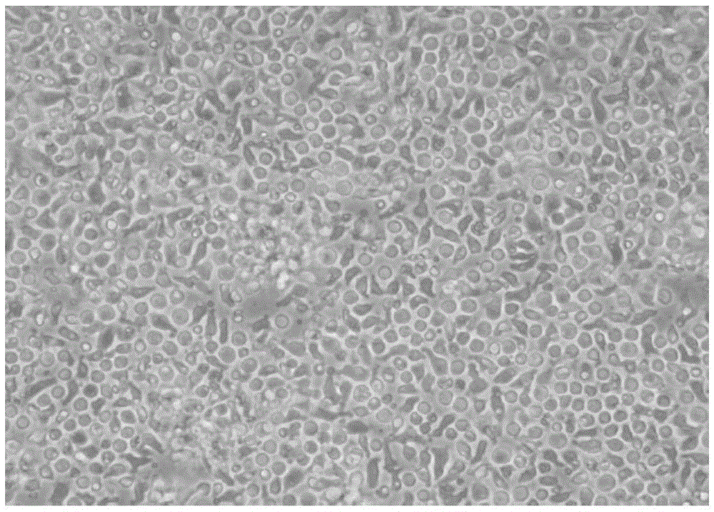 Method for increasing yield of immune cells