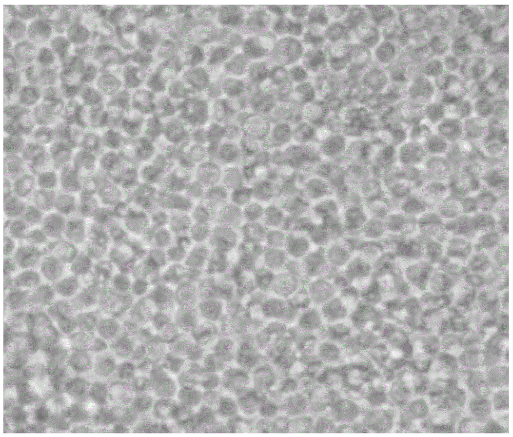 Method for increasing yield of immune cells