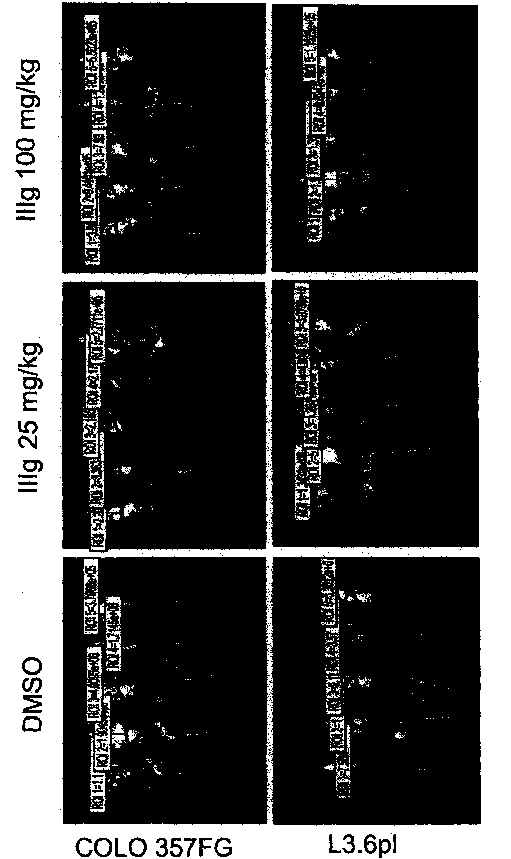 Methods and compositions for the treatment of cancer using benzopyrone-type PARP inhibitors