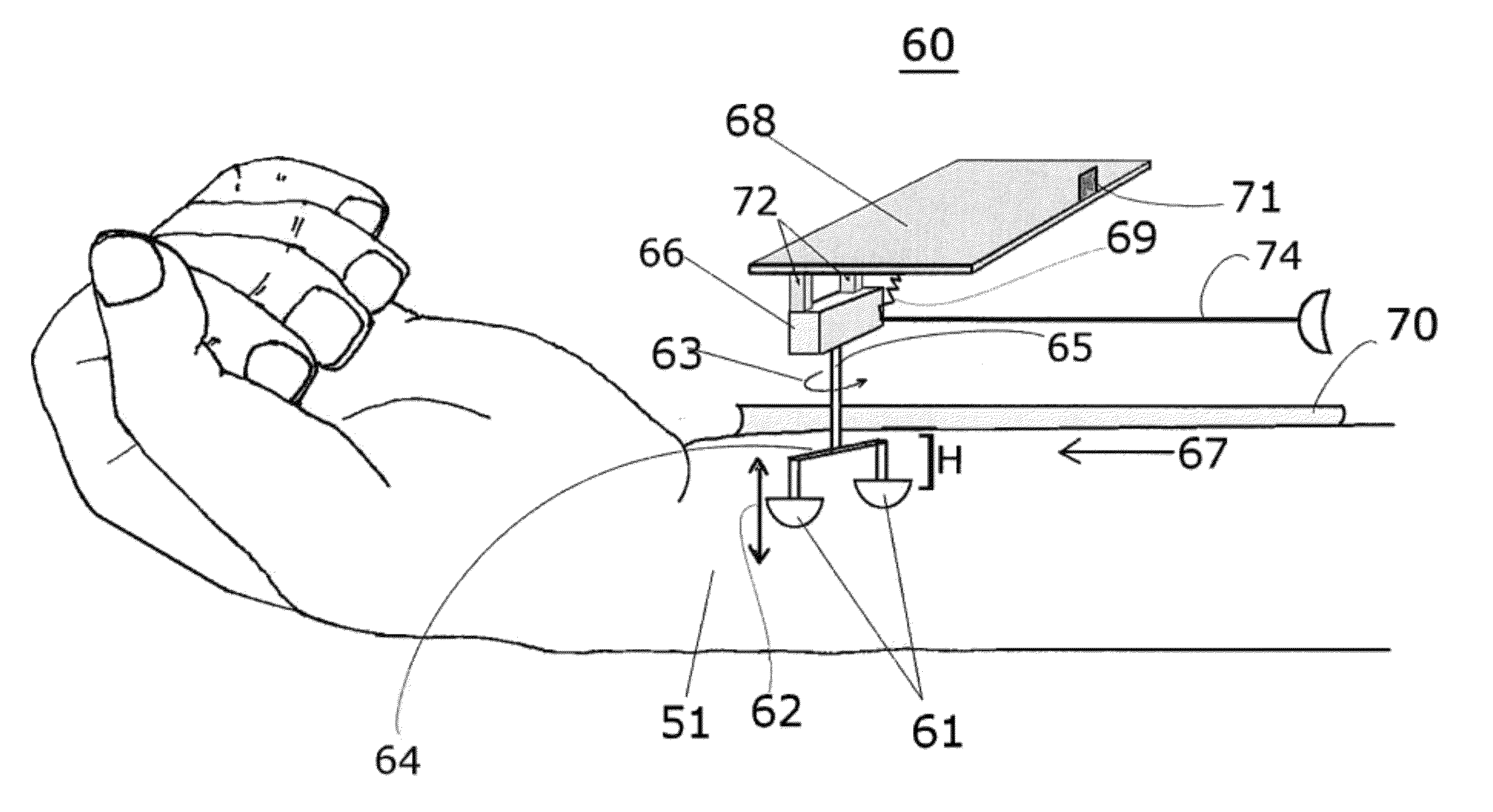 Method and device to alleviate carpal tunnel syndrome and dysfunctions of other soft tissues