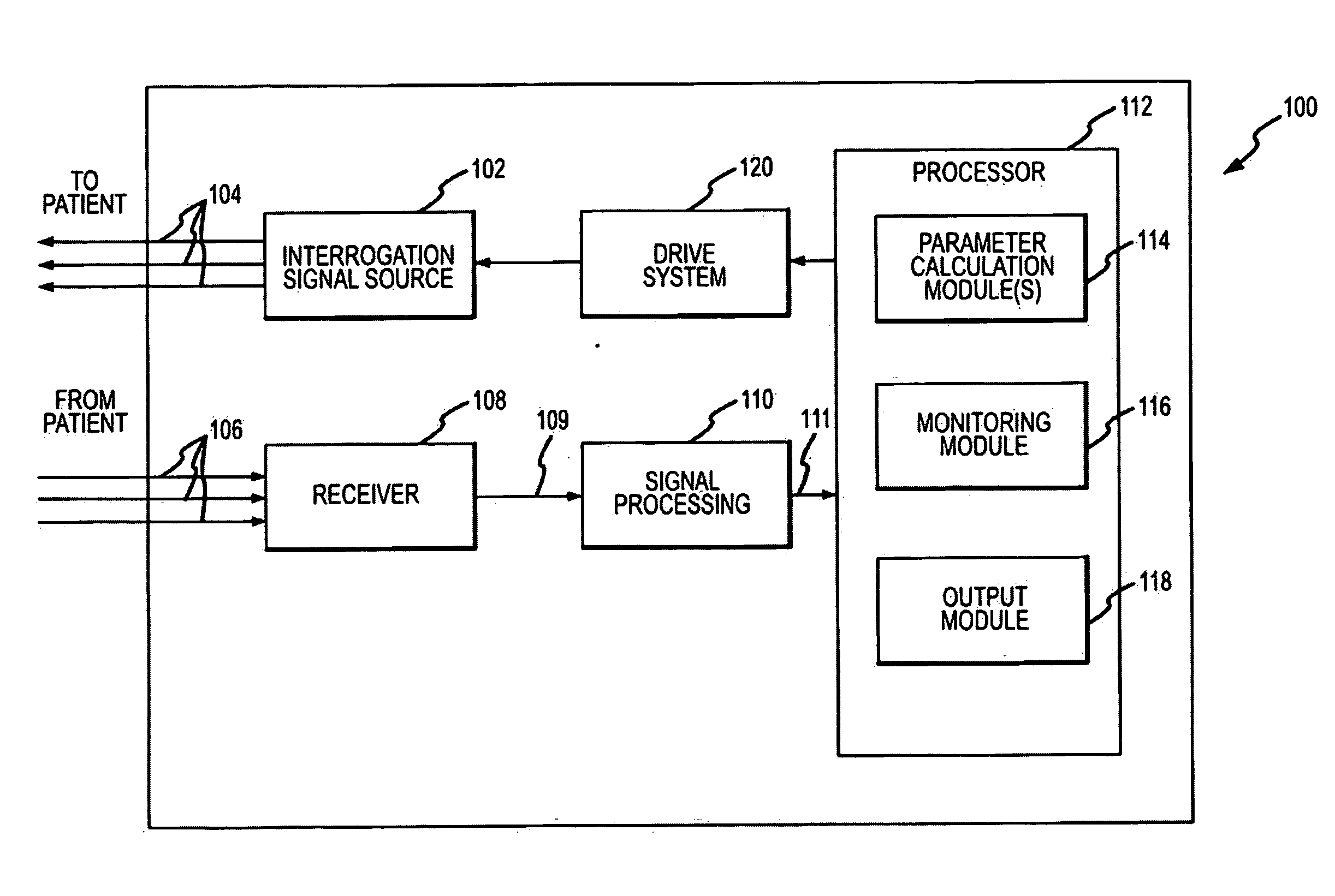 Ocular parameter sensing for cerebral perfusion monitoring and other applications